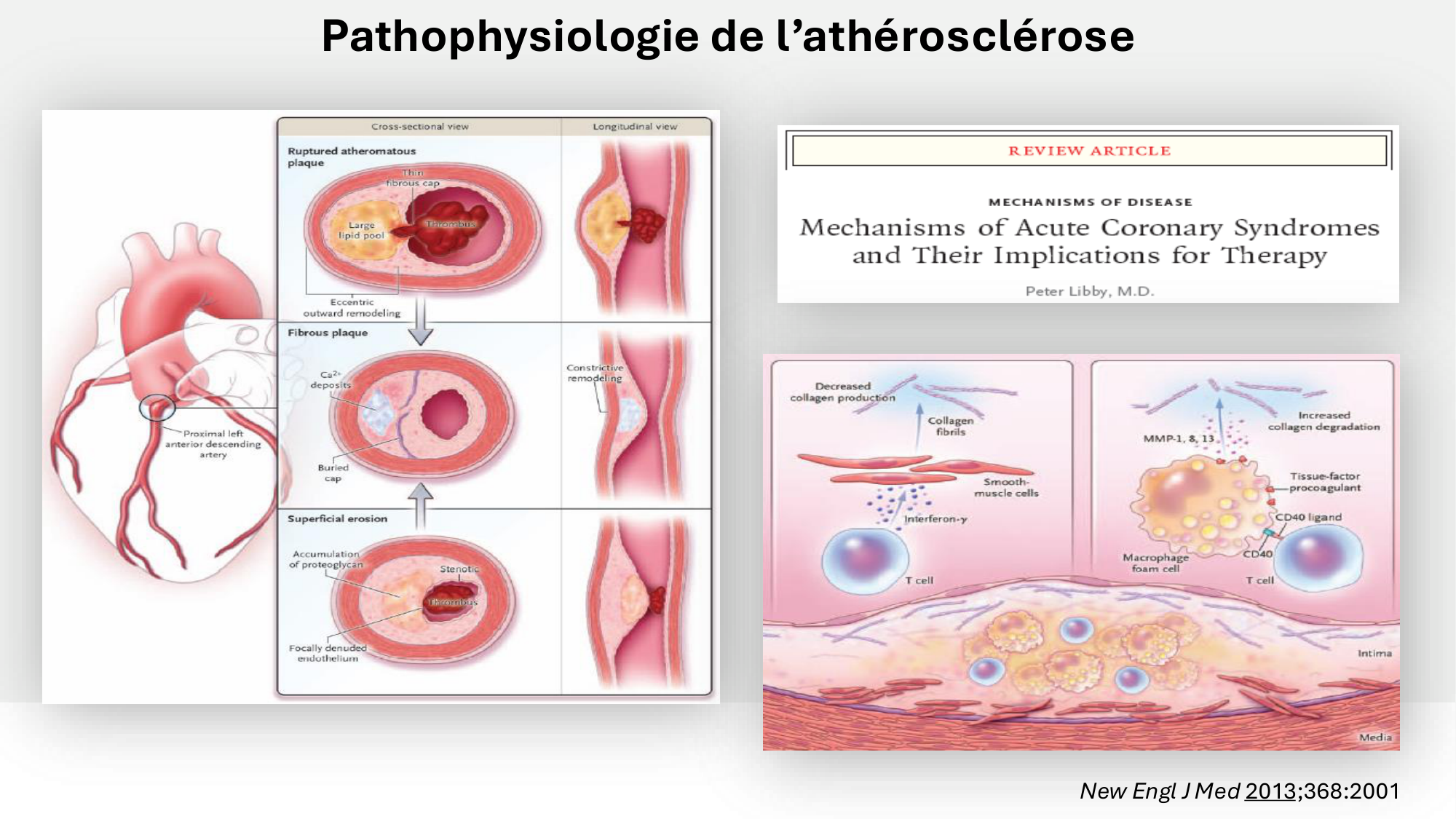 F-Mach-Cas de-liaison-Athero-6-29.1.2026.pdf page 18
