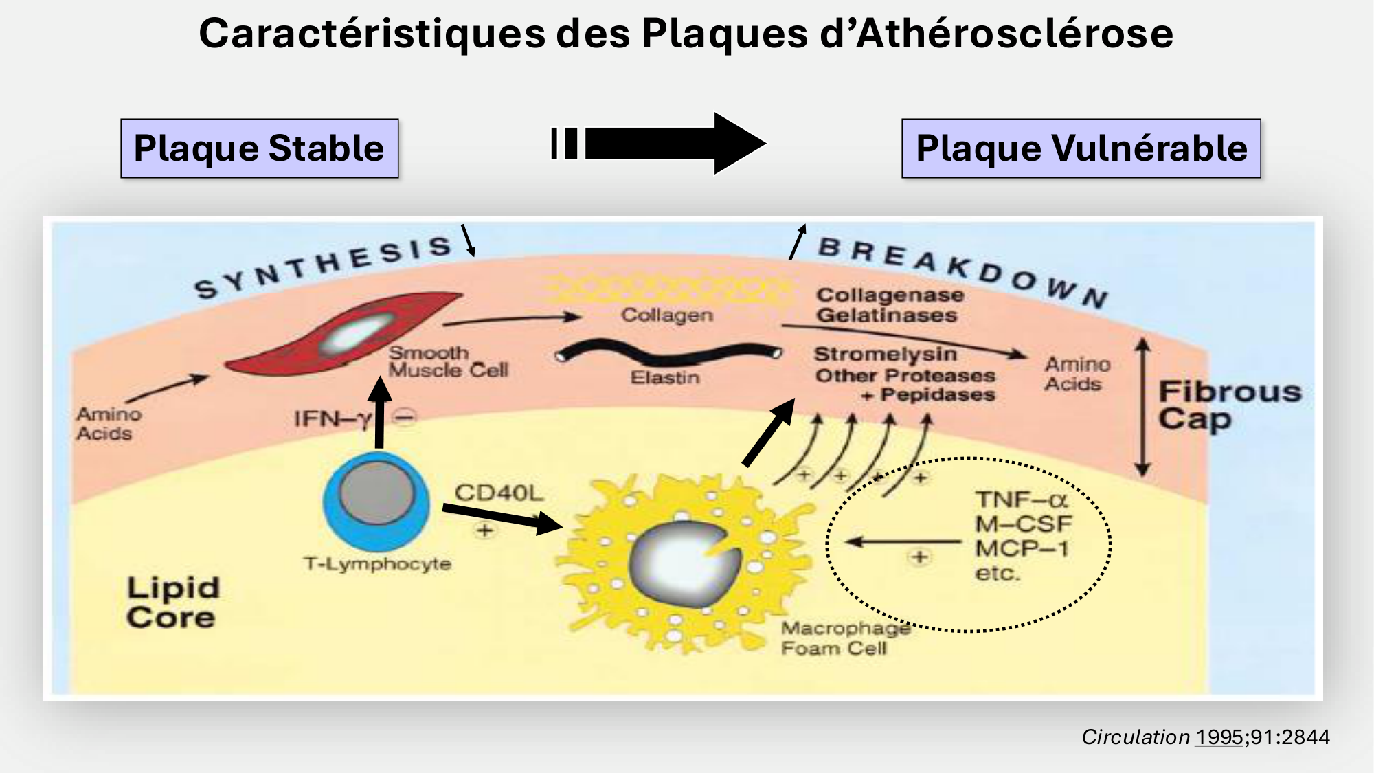 F-Mach-Cas de-liaison-Athero-6-29.1.2026.pdf page 29