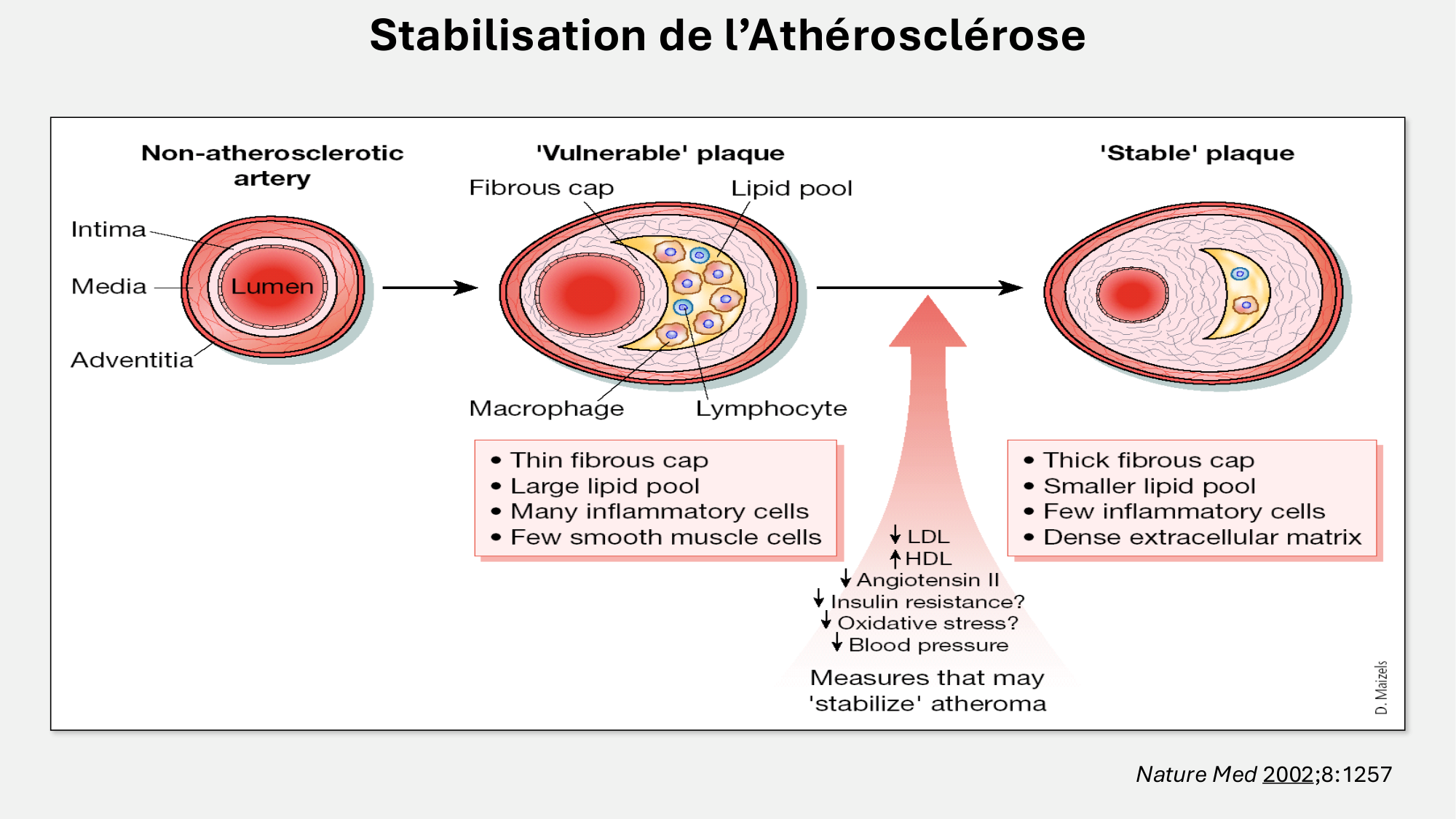 F-Mach-Cas de-liaison-Athero-6-29.1.2026.pdf page 32