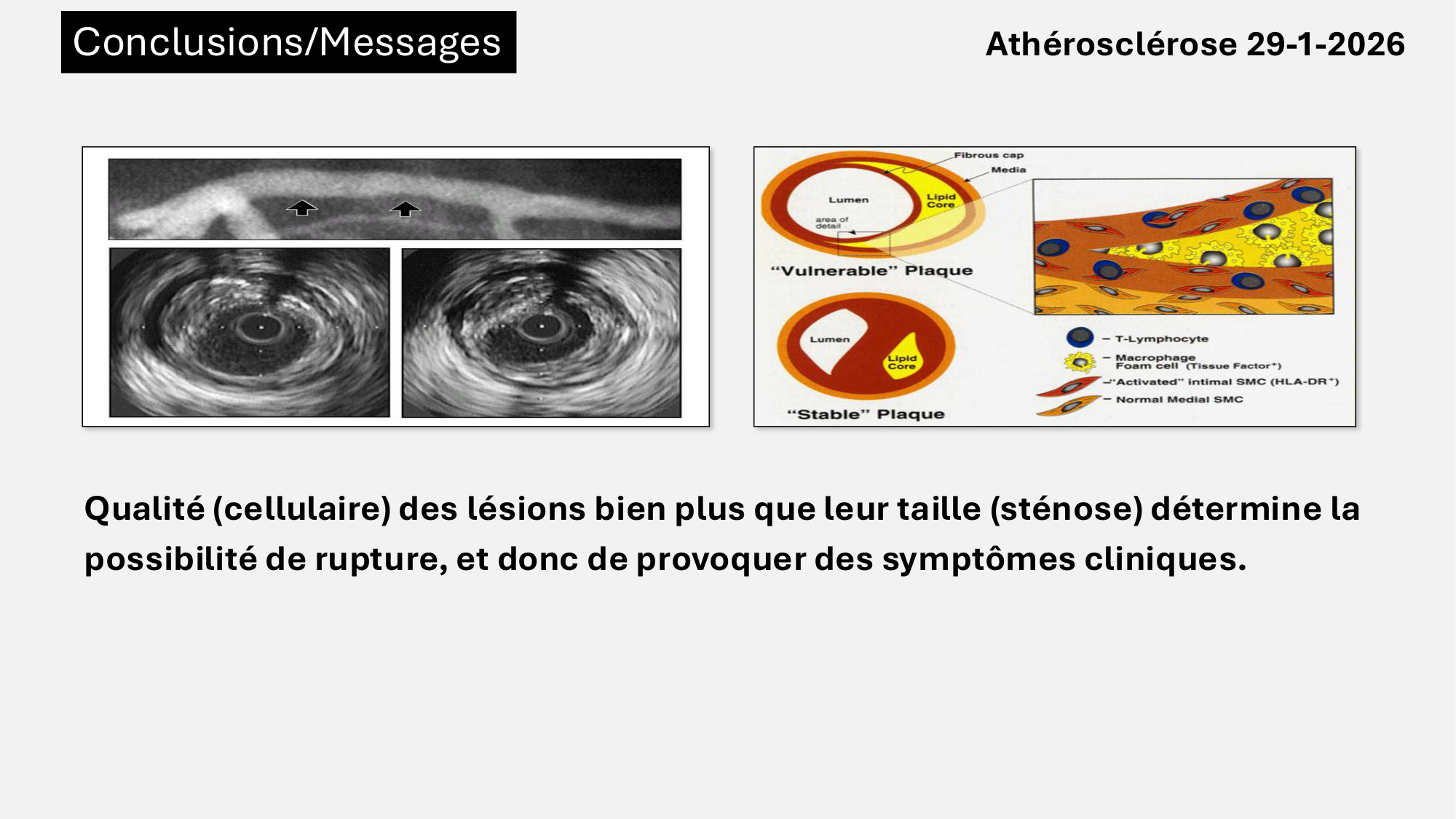F-Mach-Cas de-liaison-Athero-6-29.1.2026.pdf page 52