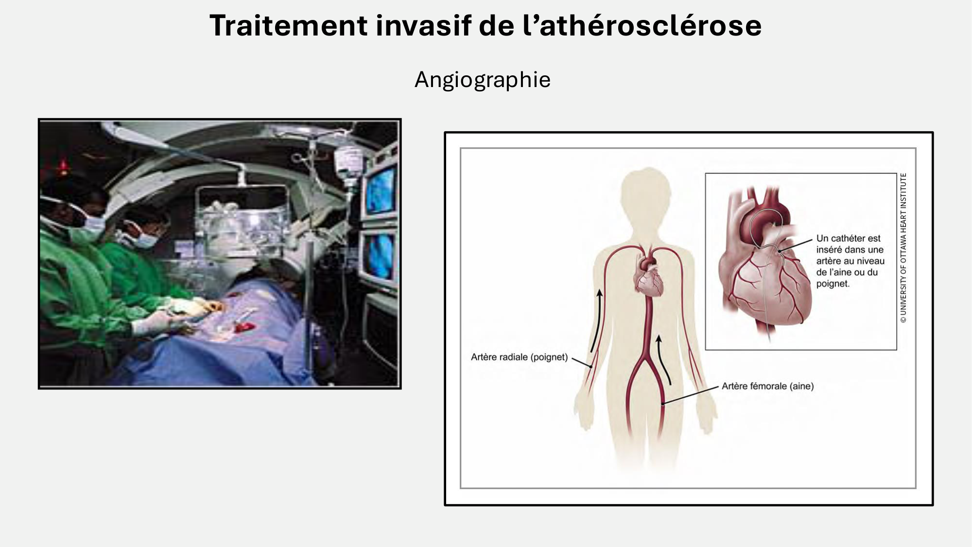 F-Mach-Cas de-liaison-Athero-7-5.3.2026 page 18