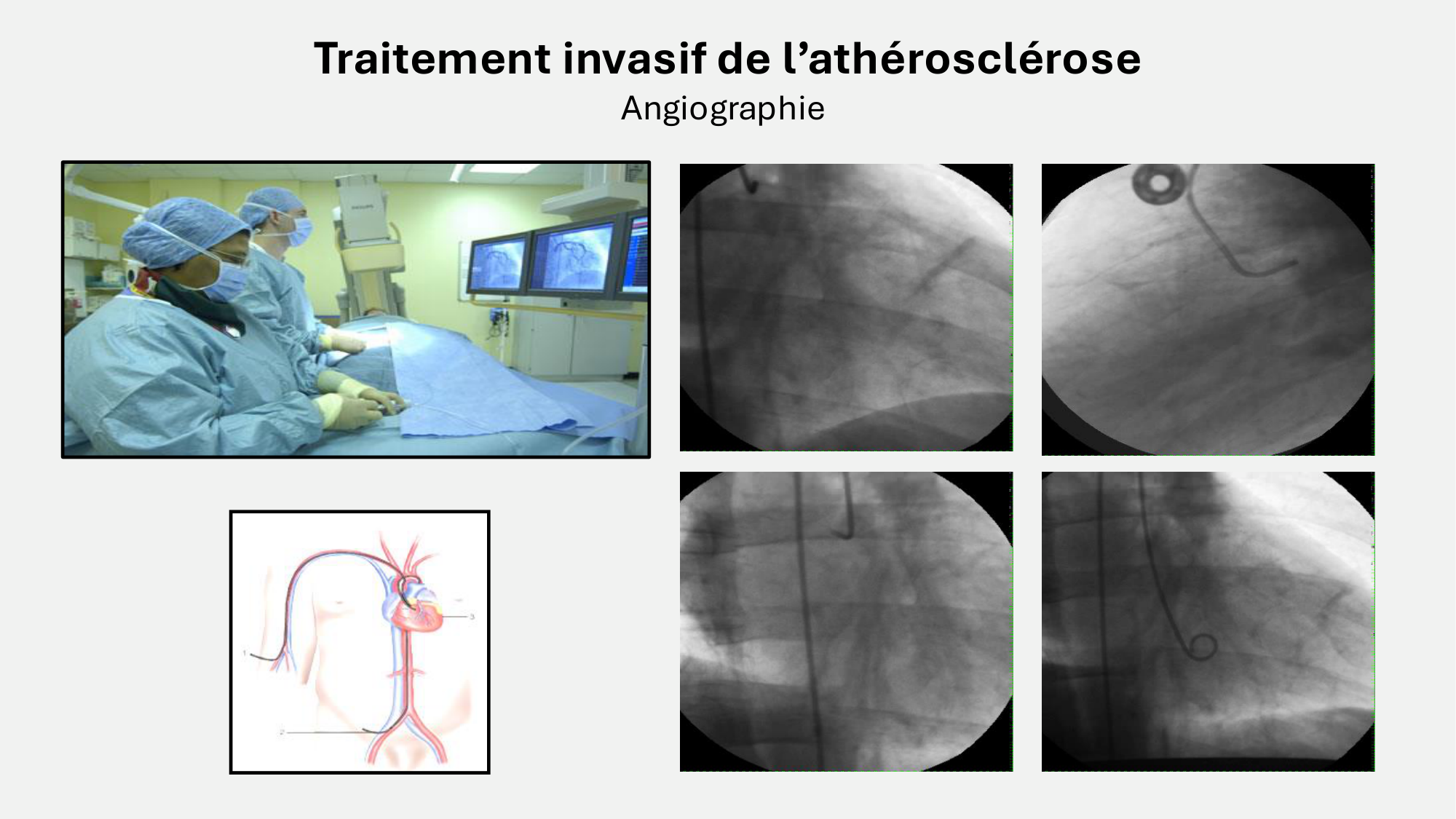 F-Mach-Cas de-liaison-Athero-7-5.3.2026 page 19