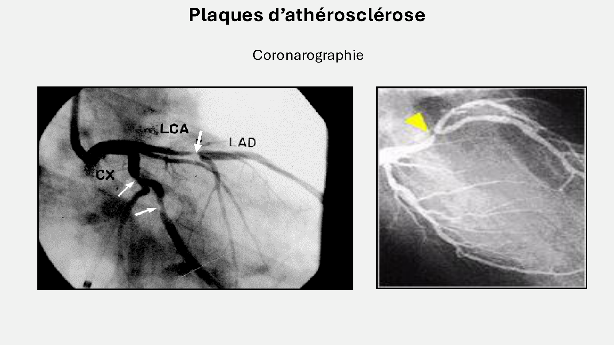 F-Mach-Cas de-liaison-Athero-7-5.3.2026 page 20