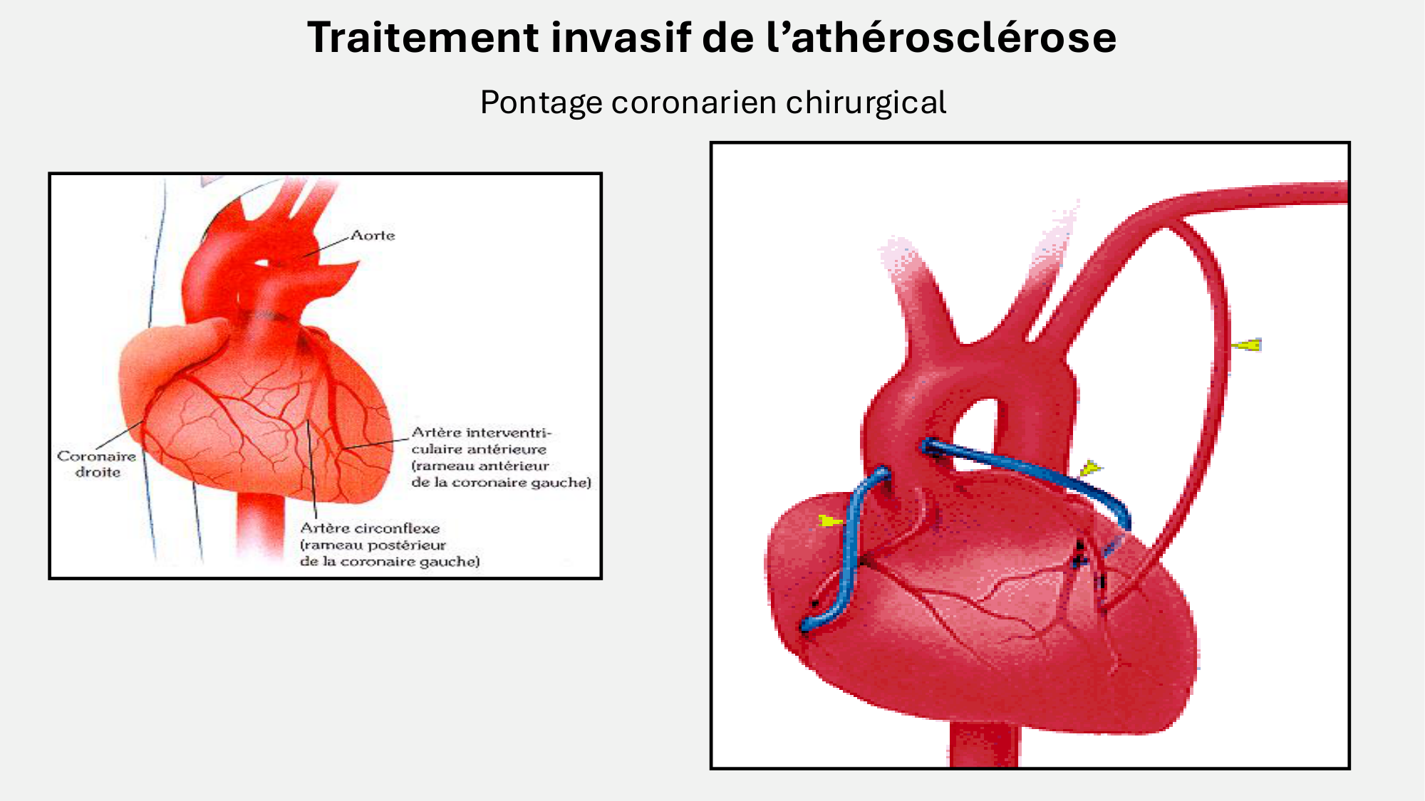 F-Mach-Cas de-liaison-Athero-7-5.3.2026 page 21