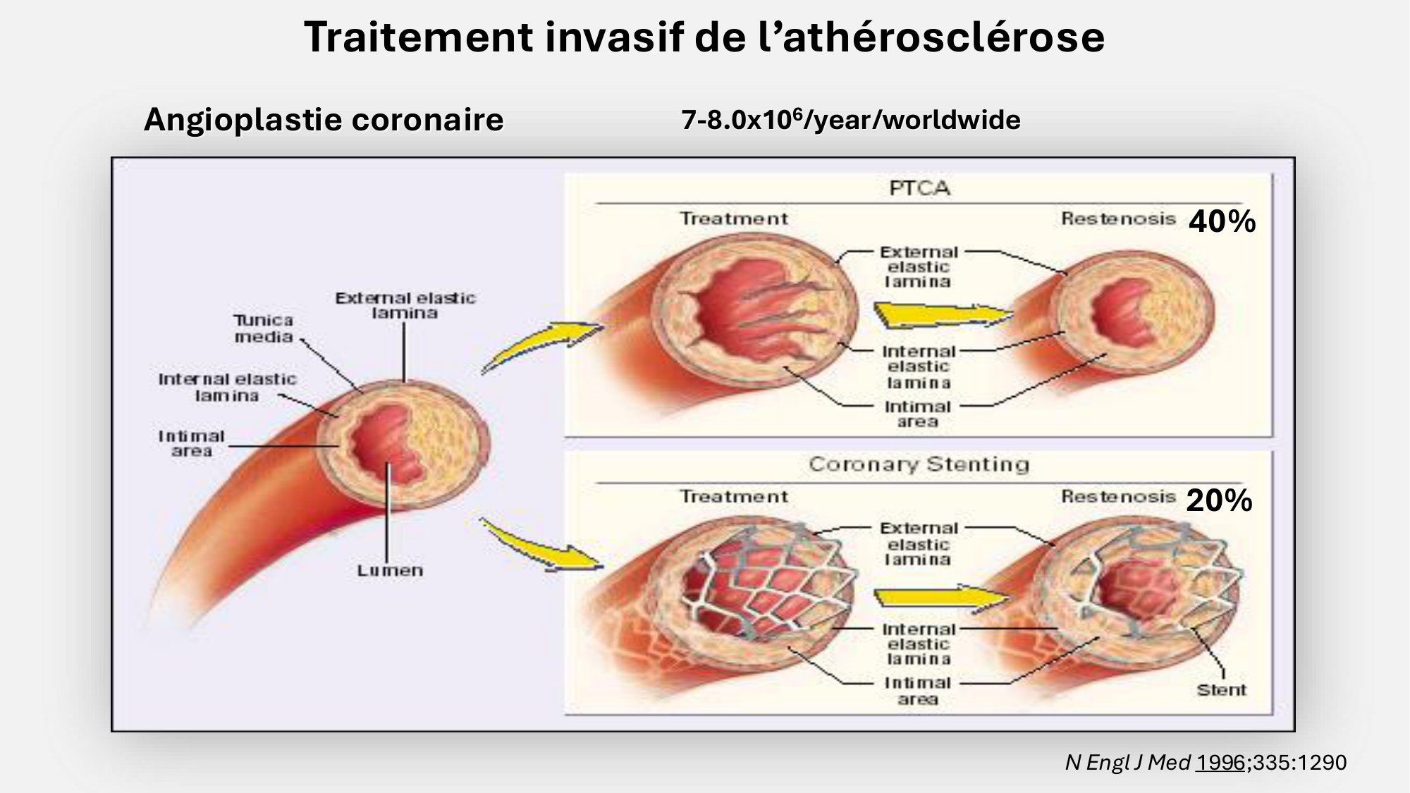 F-Mach-Cas de-liaison-Athero-7-5.3.2026 page 24