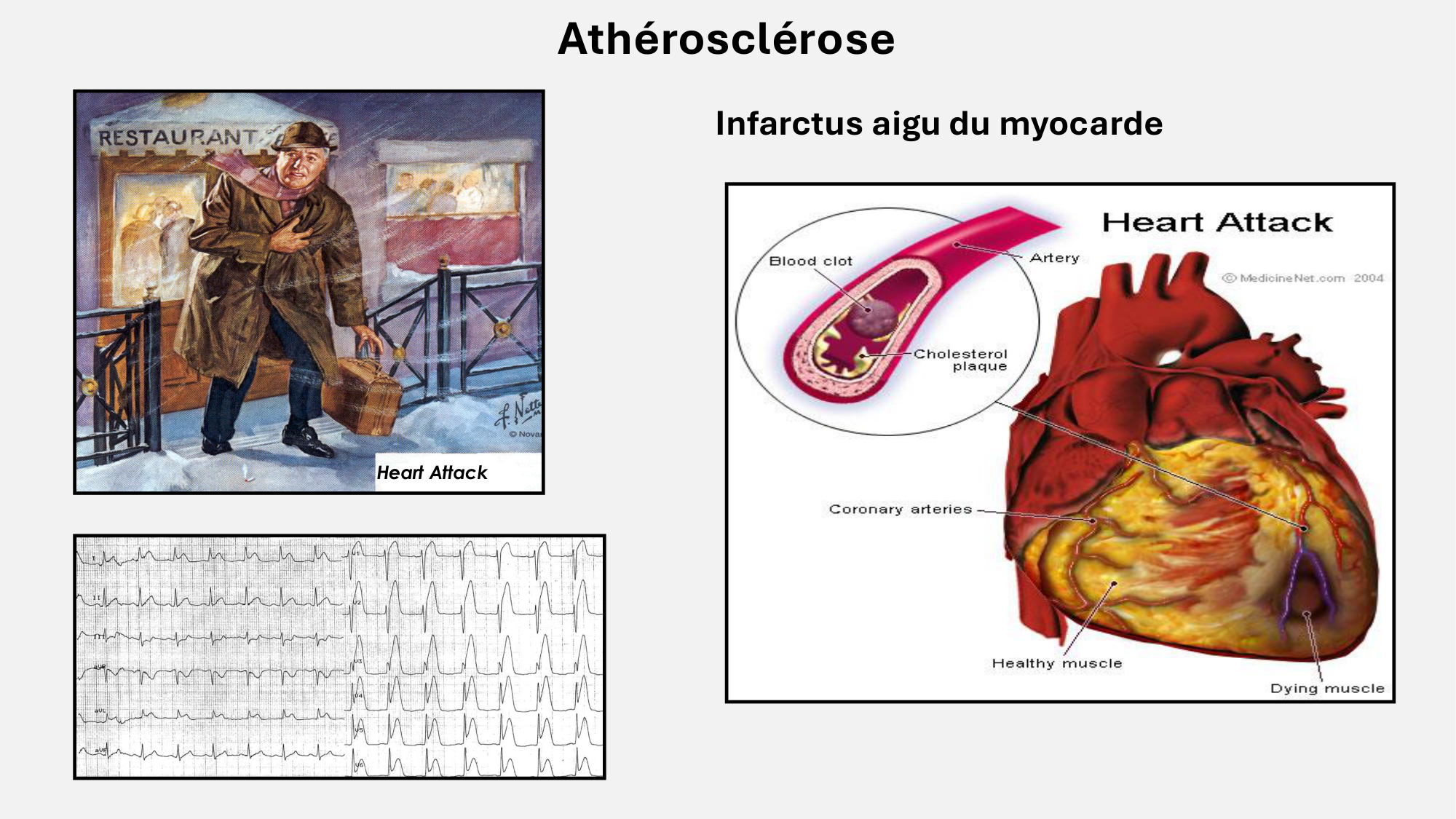F-Mach-Cas de-liaison-Athero-7-5.3.2026 page 30