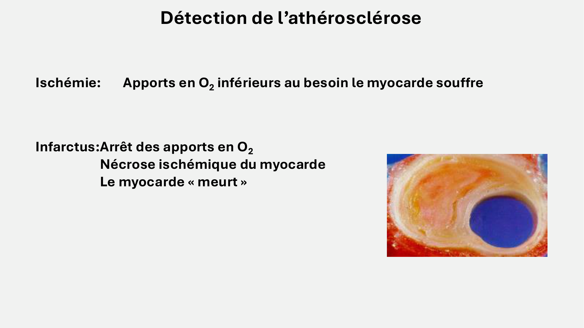 F-Mach-Cas de-liaison-Athero-8-26.3.2026 page 2