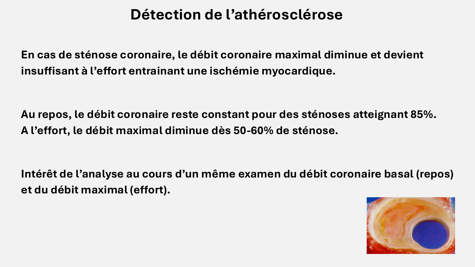 F-Mach-Cas de-liaison-Athero-8-26.3.2026 page 4