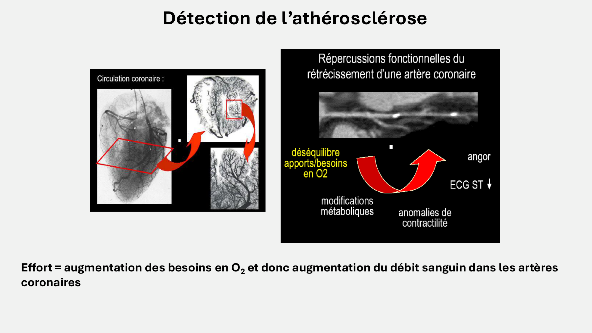 F-Mach-Cas de-liaison-Athero-8-26.3.2026 page 5
