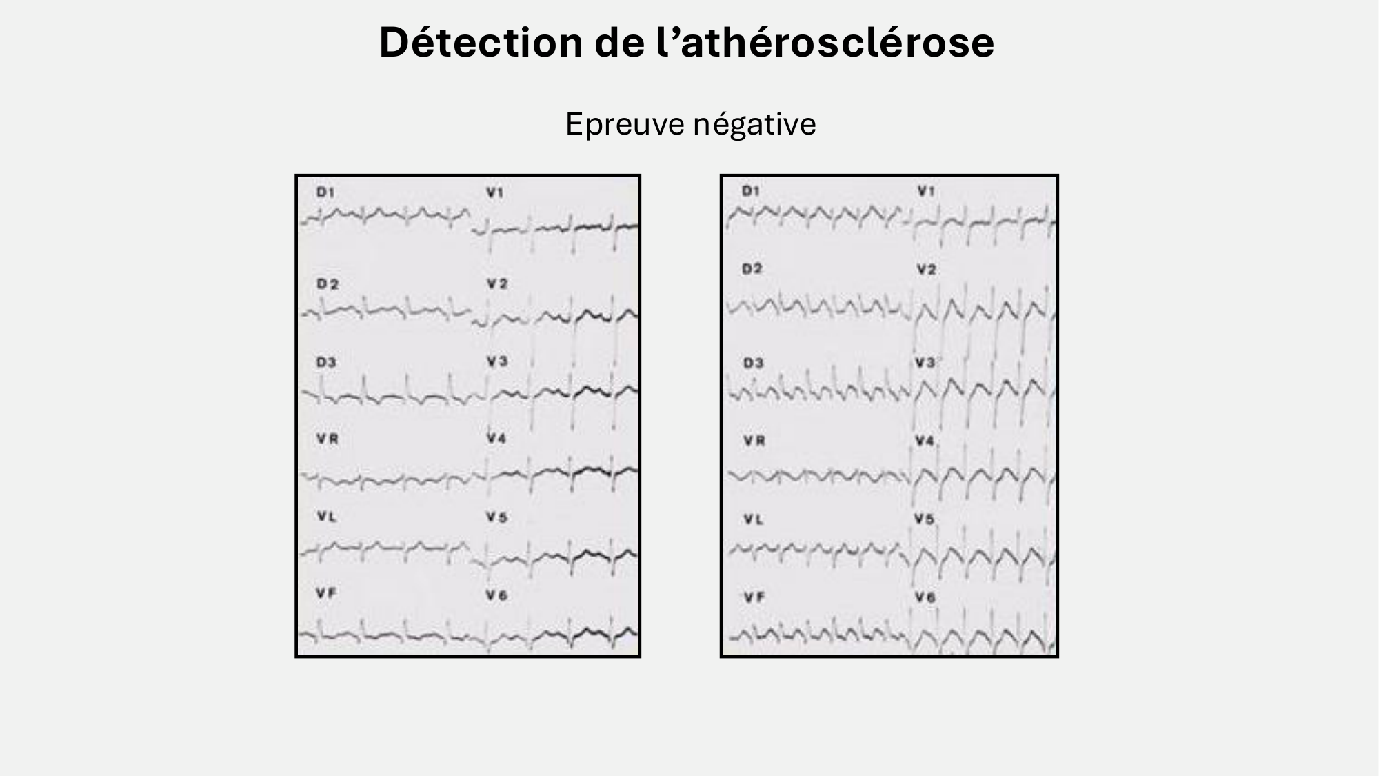 F-Mach-Cas de-liaison-Athero-8-26.3.2026 page 10