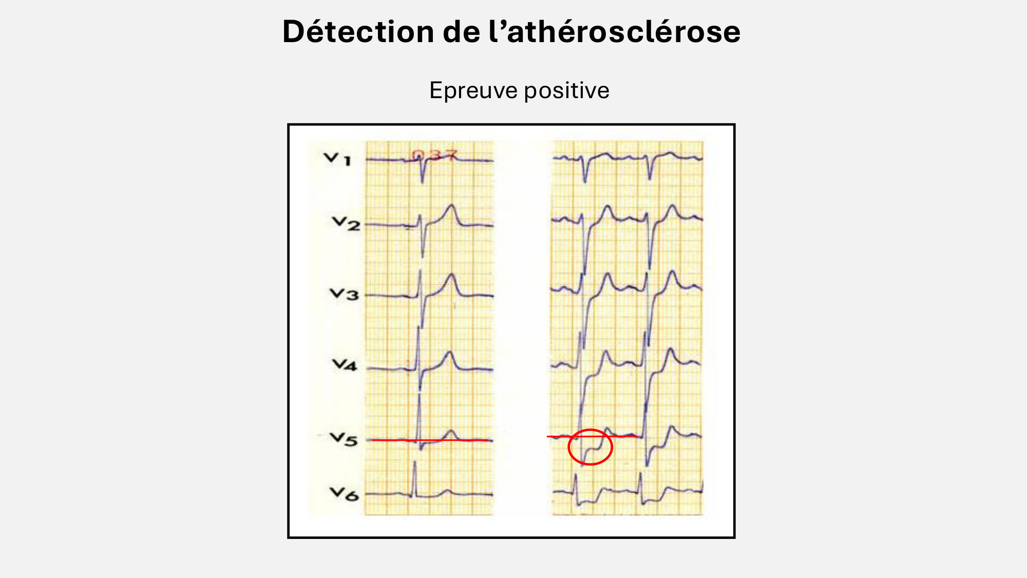 F-Mach-Cas de-liaison-Athero-8-26.3.2026 page 11