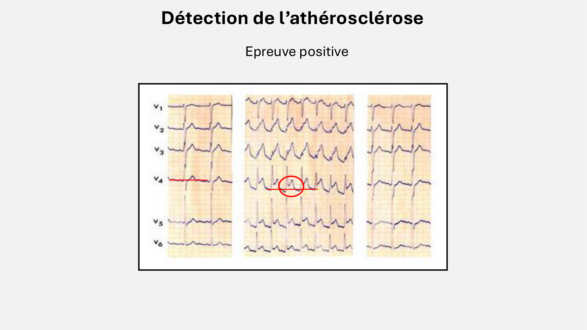 F-Mach-Cas de-liaison-Athero-8-26.3.2026 page 12