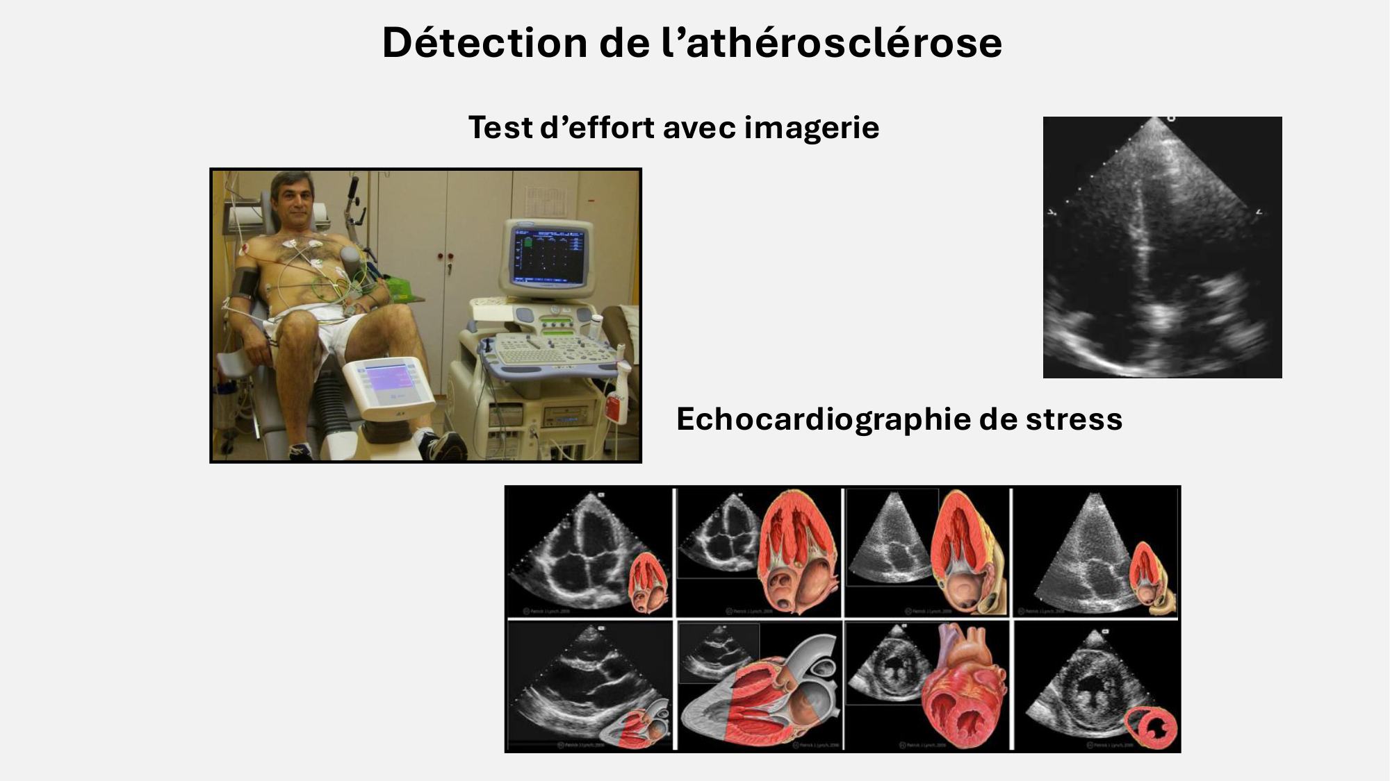 F-Mach-Cas de-liaison-Athero-8-26.3.2026 page 13