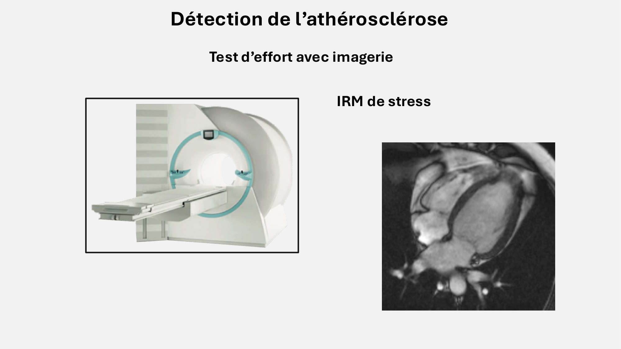 F-Mach-Cas de-liaison-Athero-8-26.3.2026 page 14