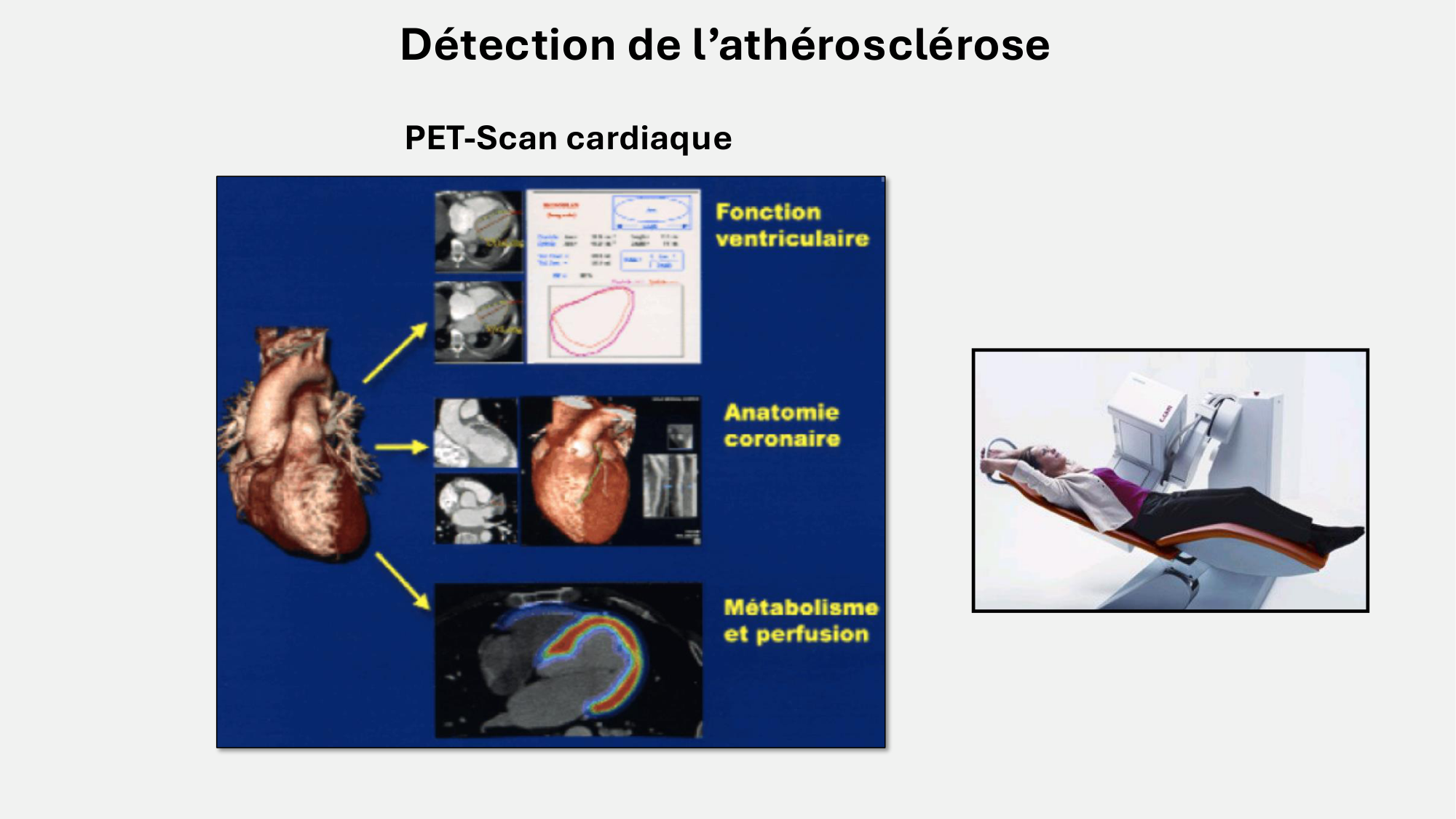 F-Mach-Cas de-liaison-Athero-8-26.3.2026 page 15