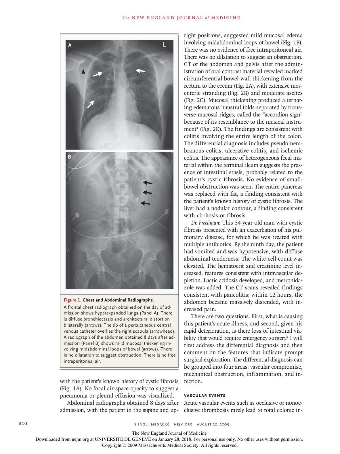 nejmcpc0902225 page 4
