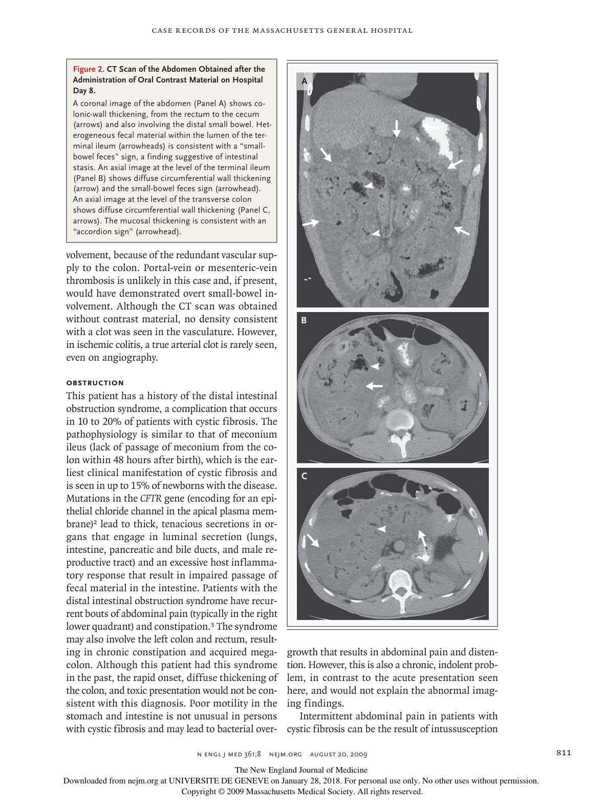nejmcpc0902225 page 5