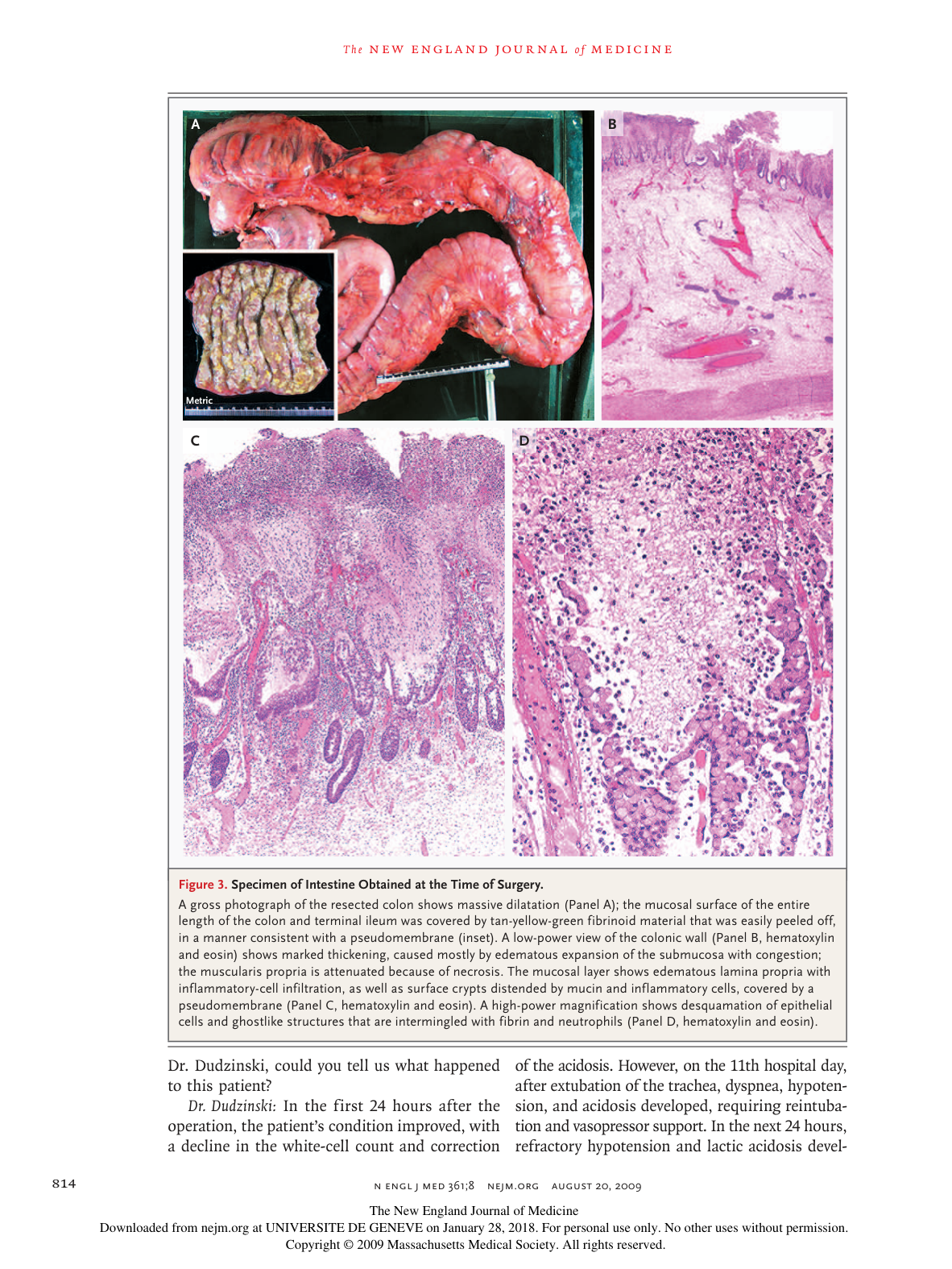 nejmcpc0902225 page 8