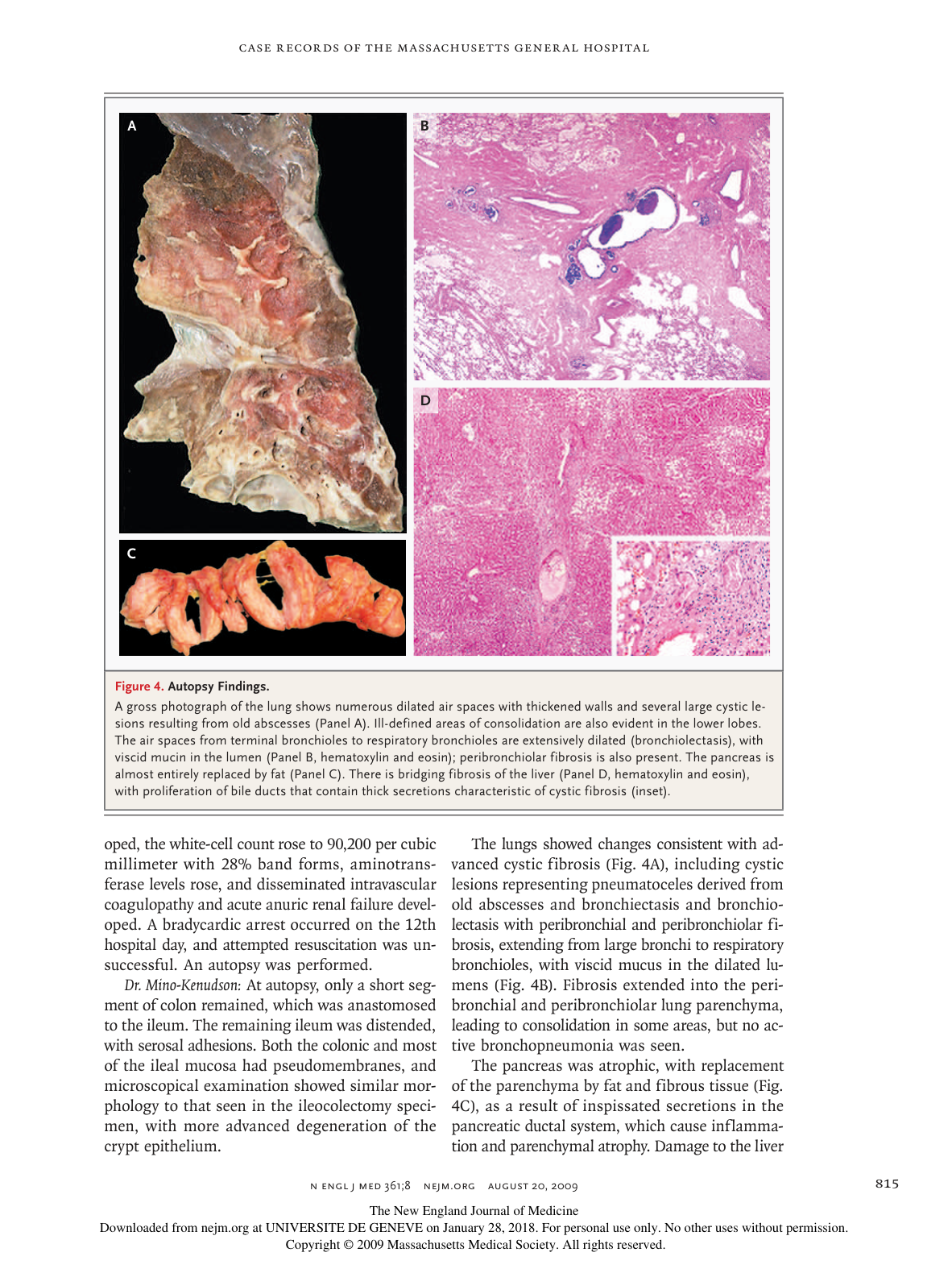 nejmcpc0902225 page 9