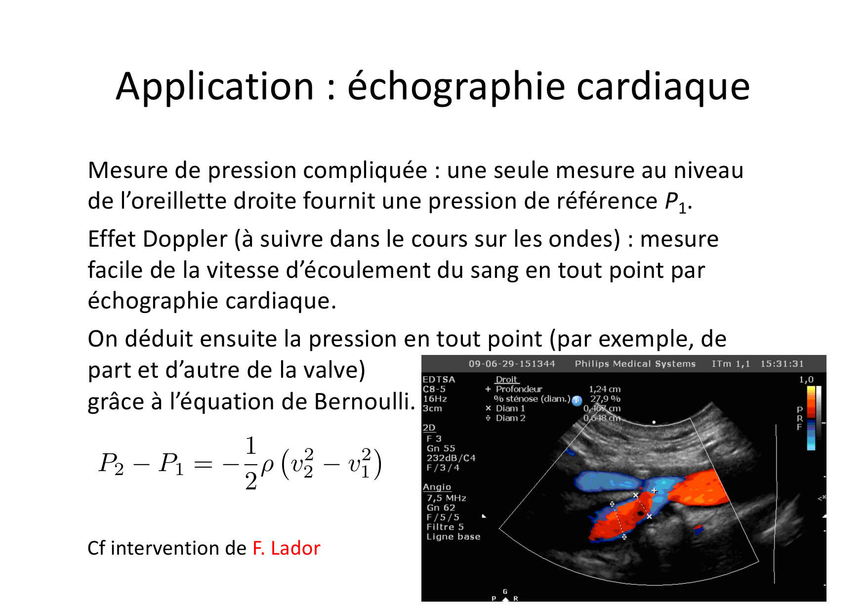 05 Mecanique des Fluides page 30