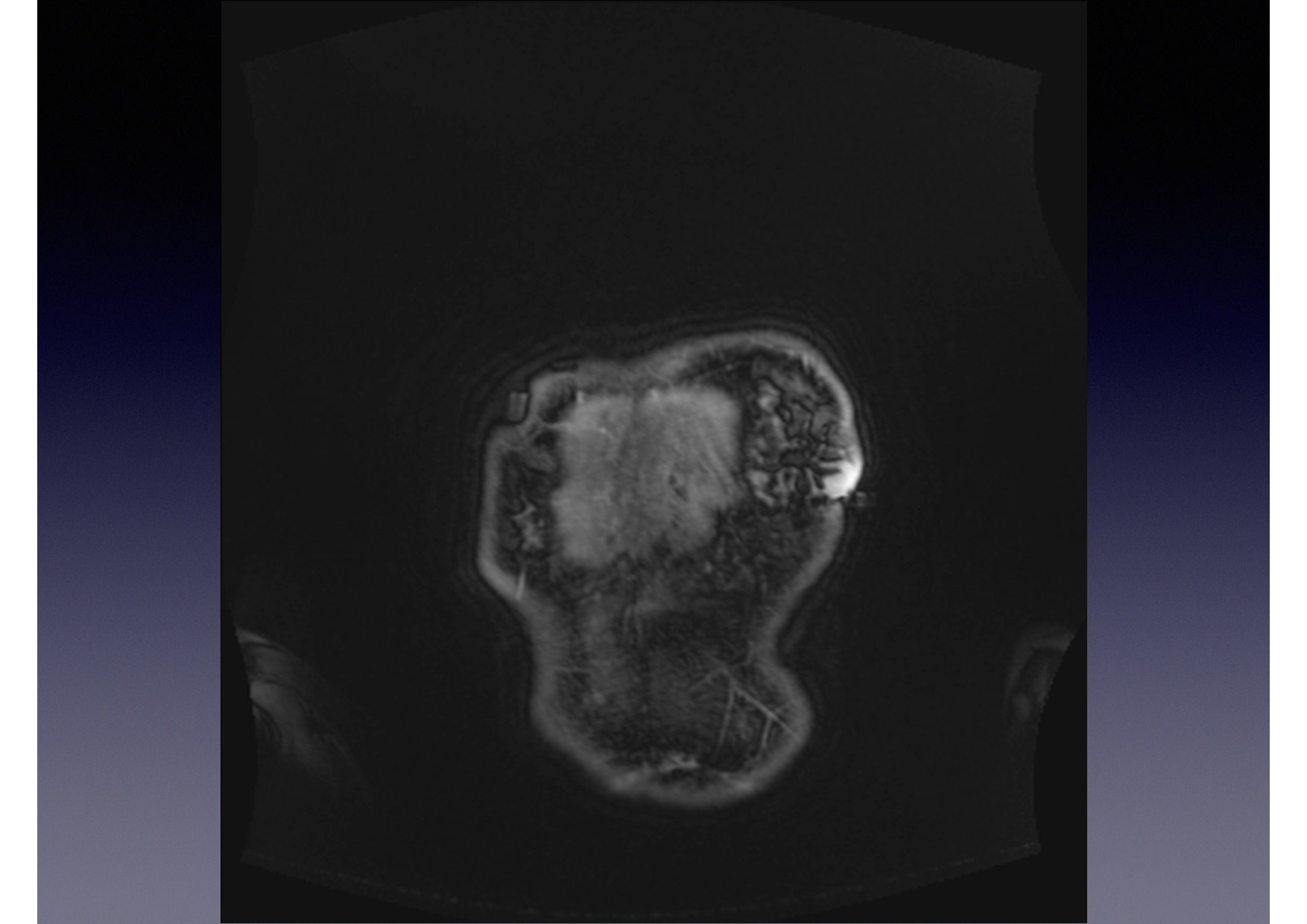 Intervention Prof JP Vallée - IRM - 17-02-2026 page 2