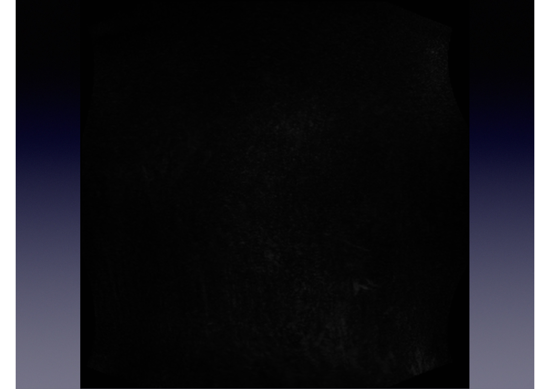 Intervention Prof JP Vallée - IRM - 17-02-2026 page 3