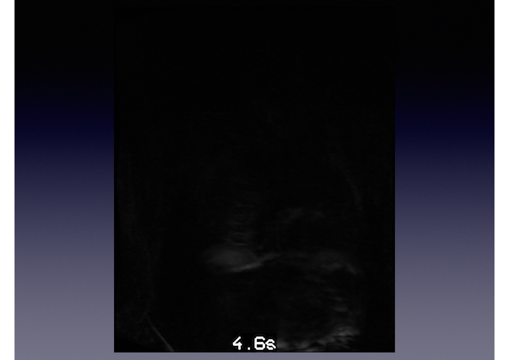 Intervention Prof JP Vallée - IRM - 17-02-2026 page 4