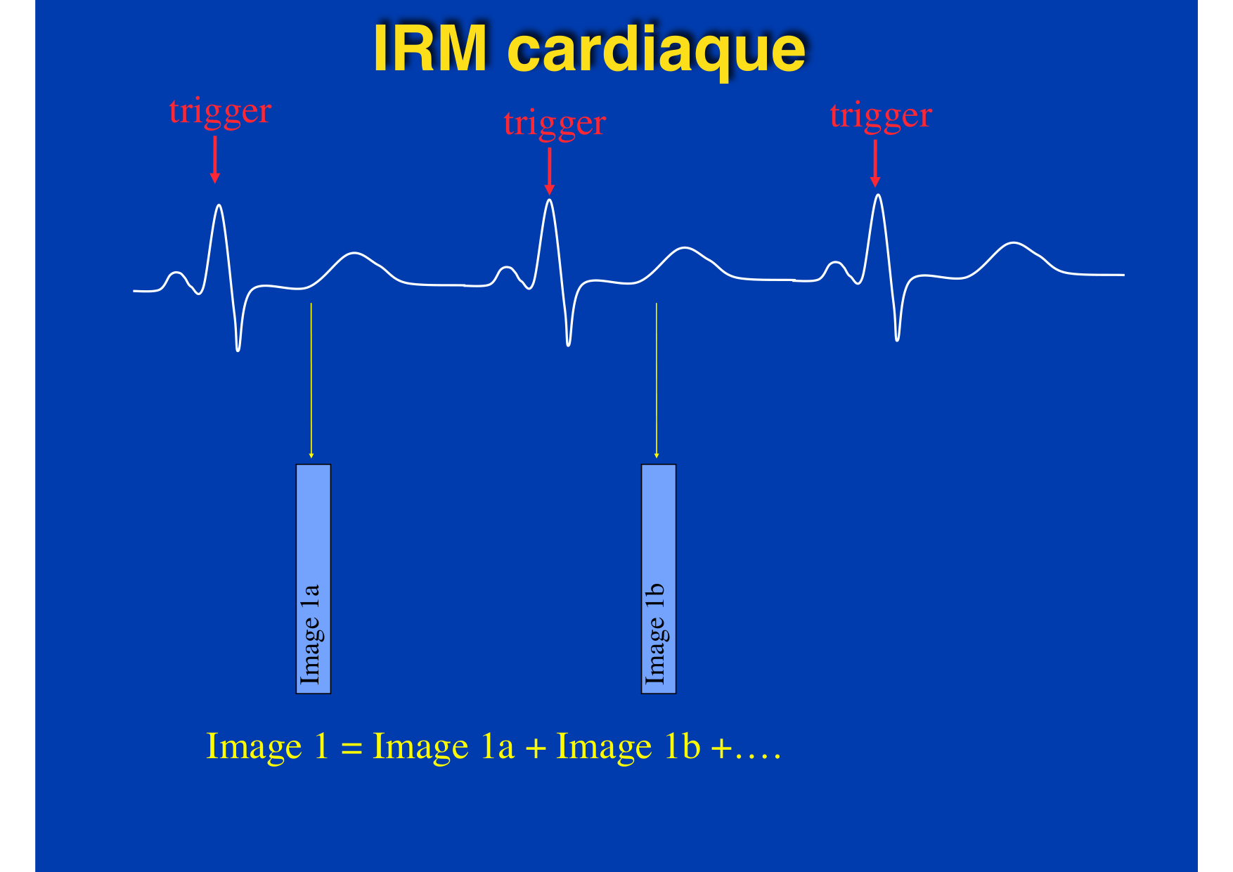 Intervention Prof JP Vallée - IRM - 17-02-2026 page 5