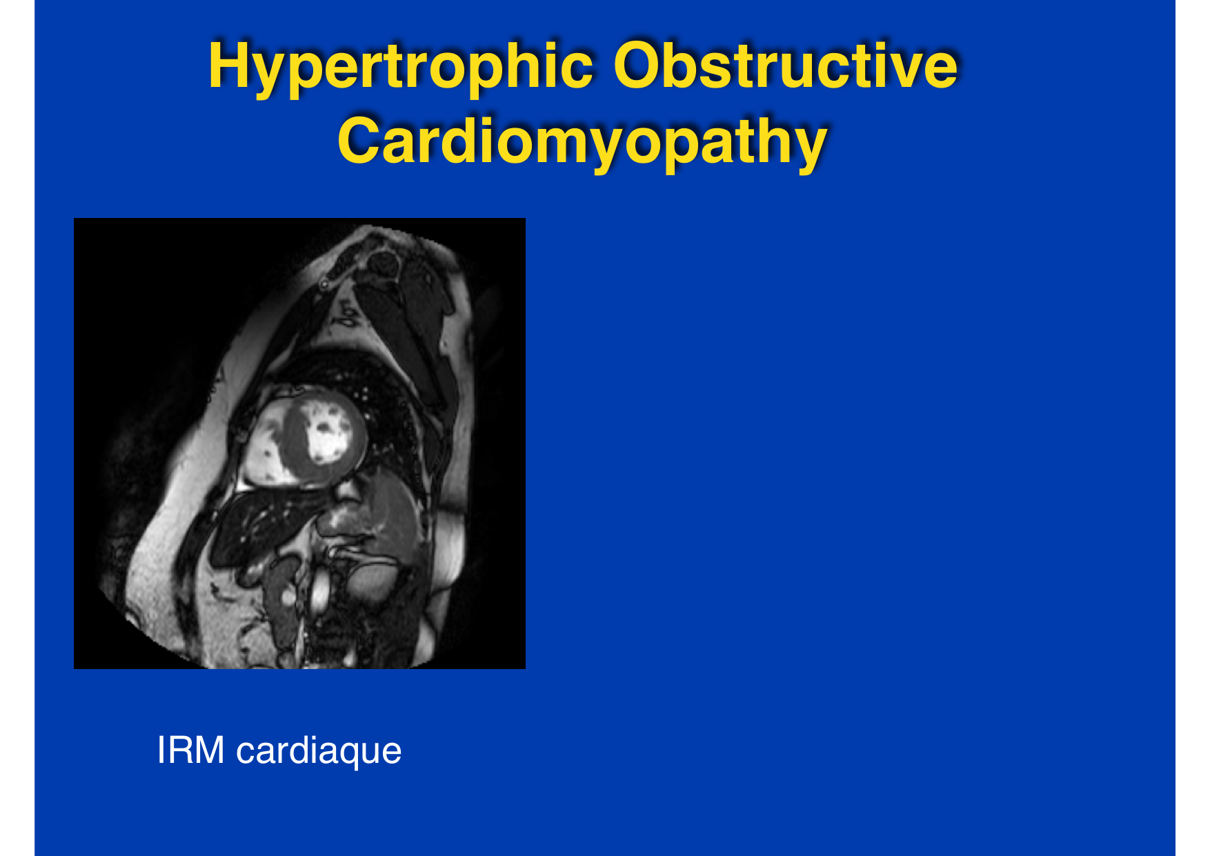 Intervention Prof JP Vallée - IRM - 17-02-2026 page 6