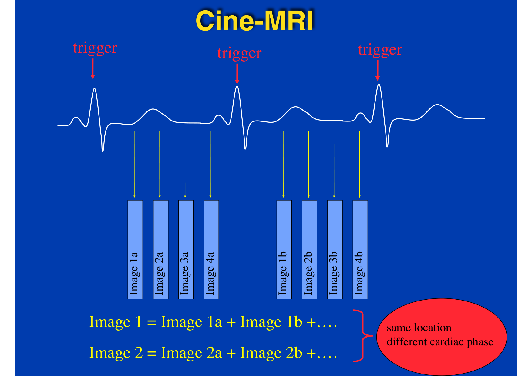 Intervention Prof JP Vallée - IRM - 17-02-2026 page 7