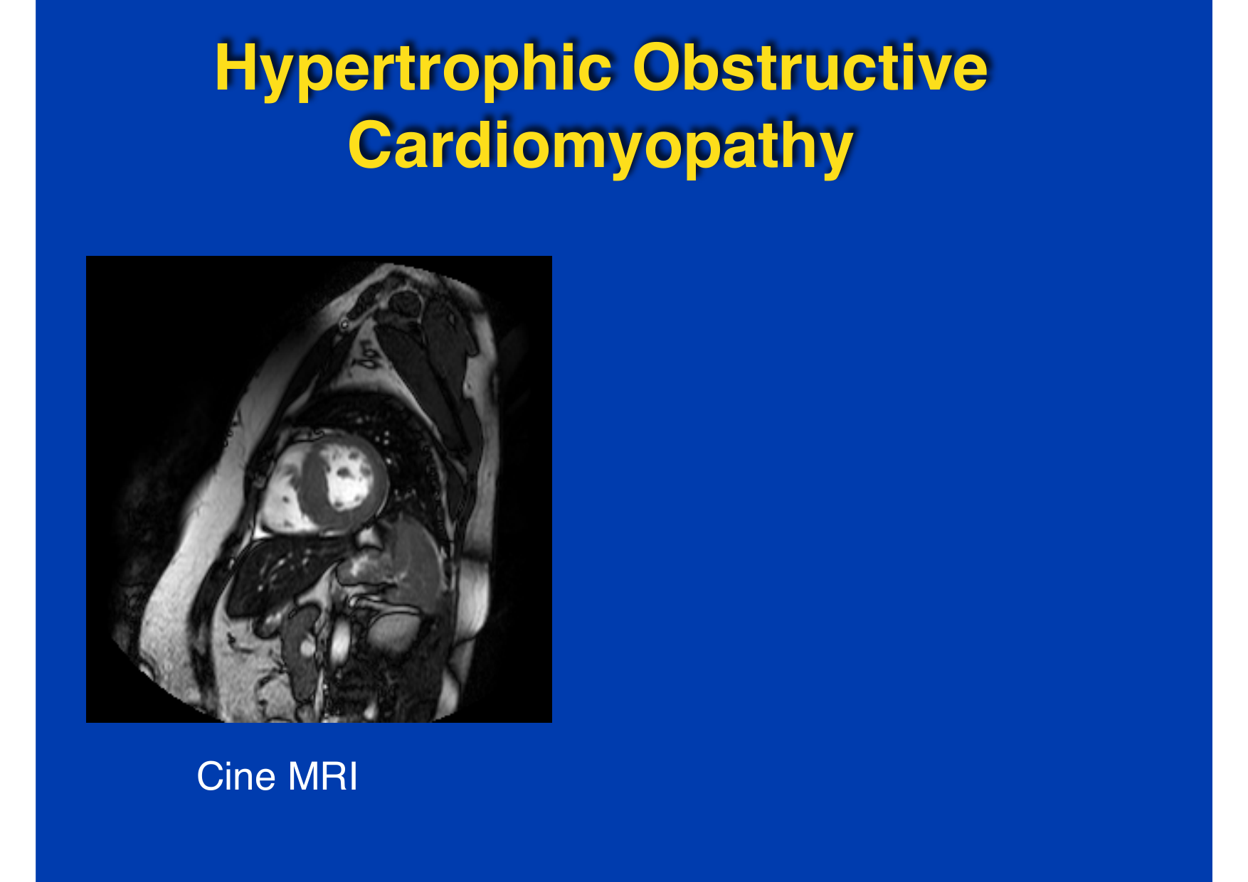 Intervention Prof JP Vallée - IRM - 17-02-2026 page 8