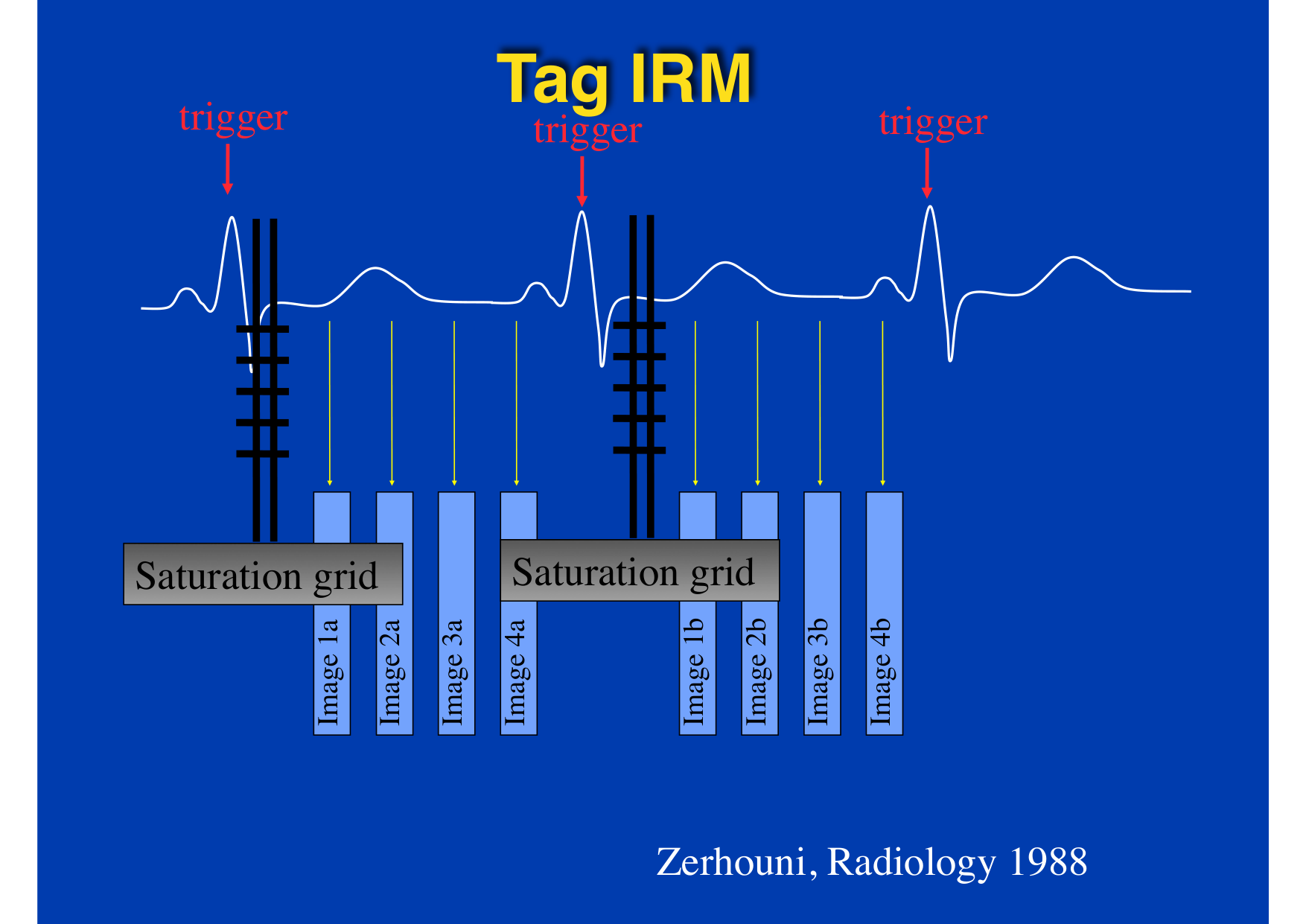 Intervention Prof JP Vallée - IRM - 17-02-2026 page 9