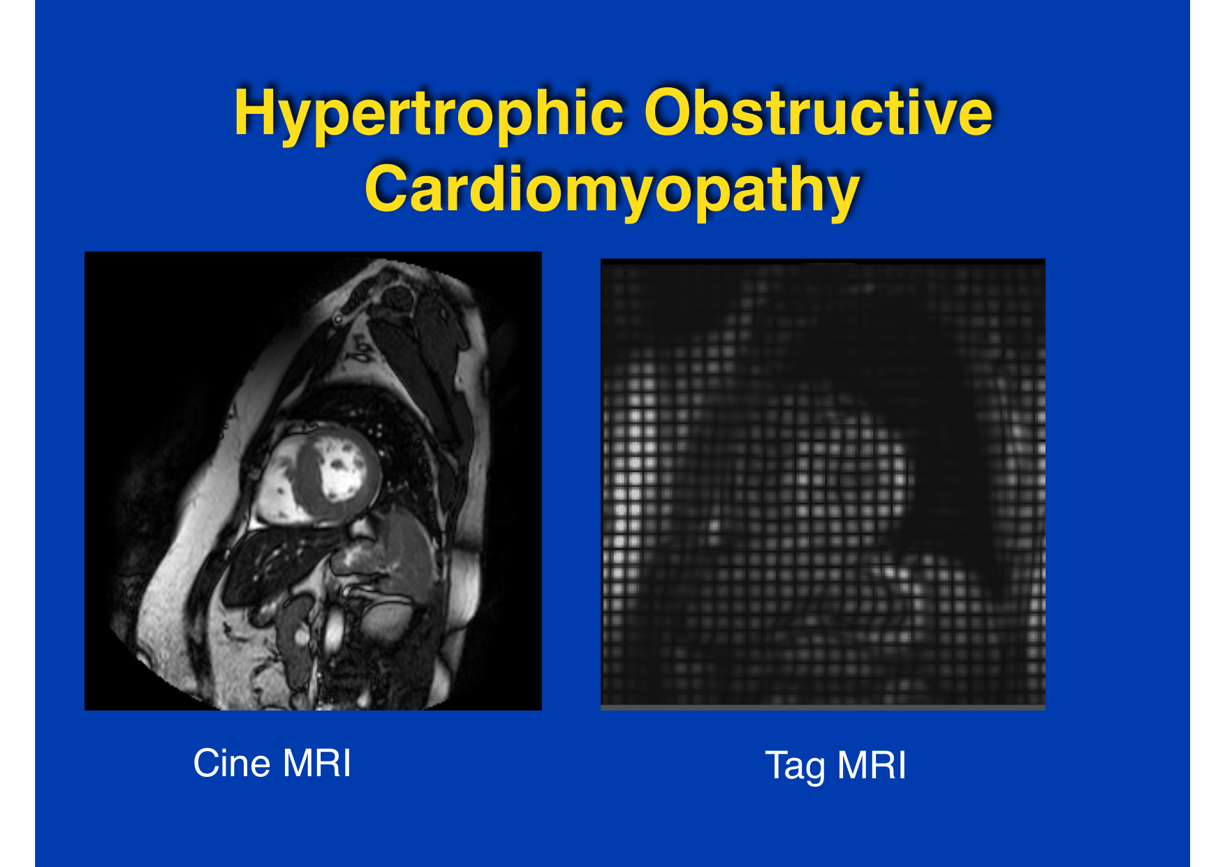 Intervention Prof JP Vallée - IRM - 17-02-2026 page 10