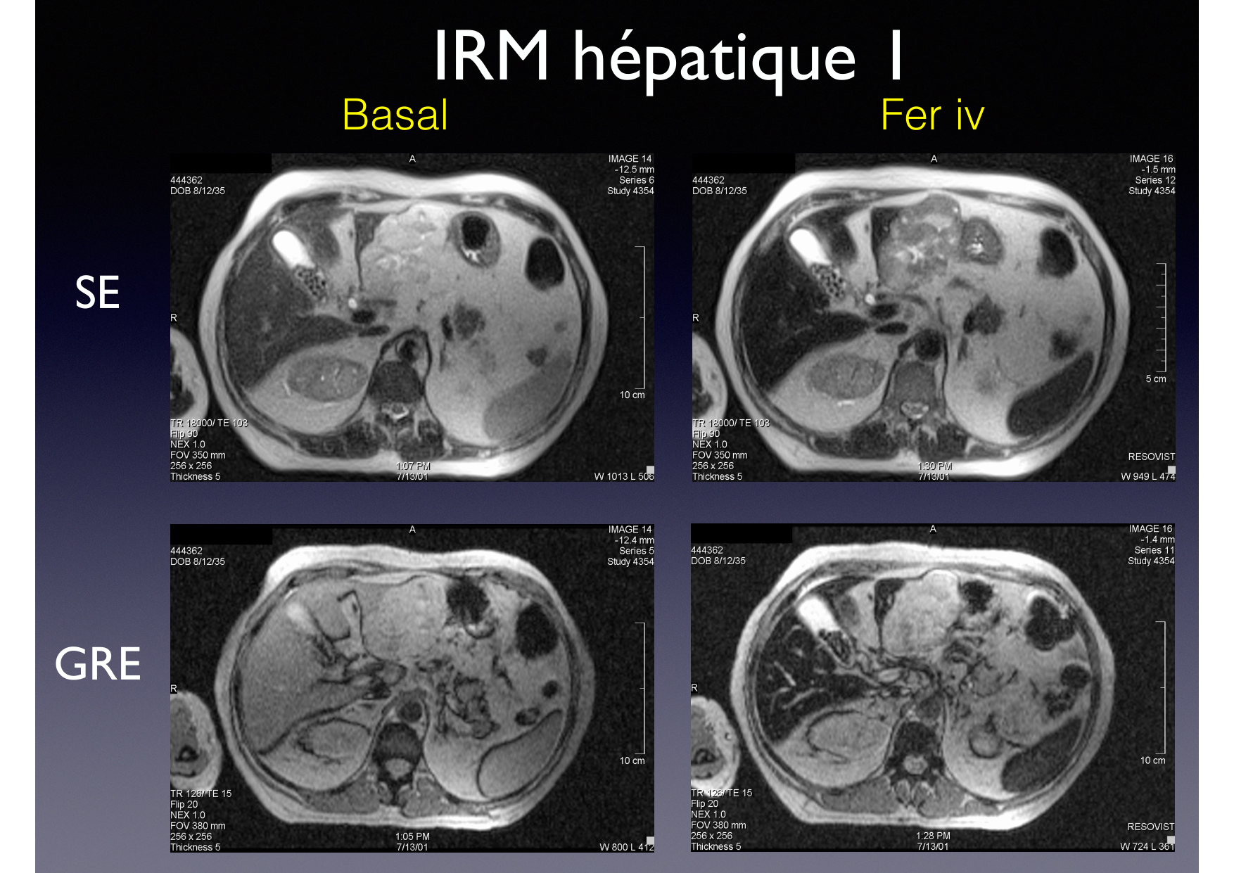 Intervention Prof JP Vallée - IRM - 17-02-2026 page 11