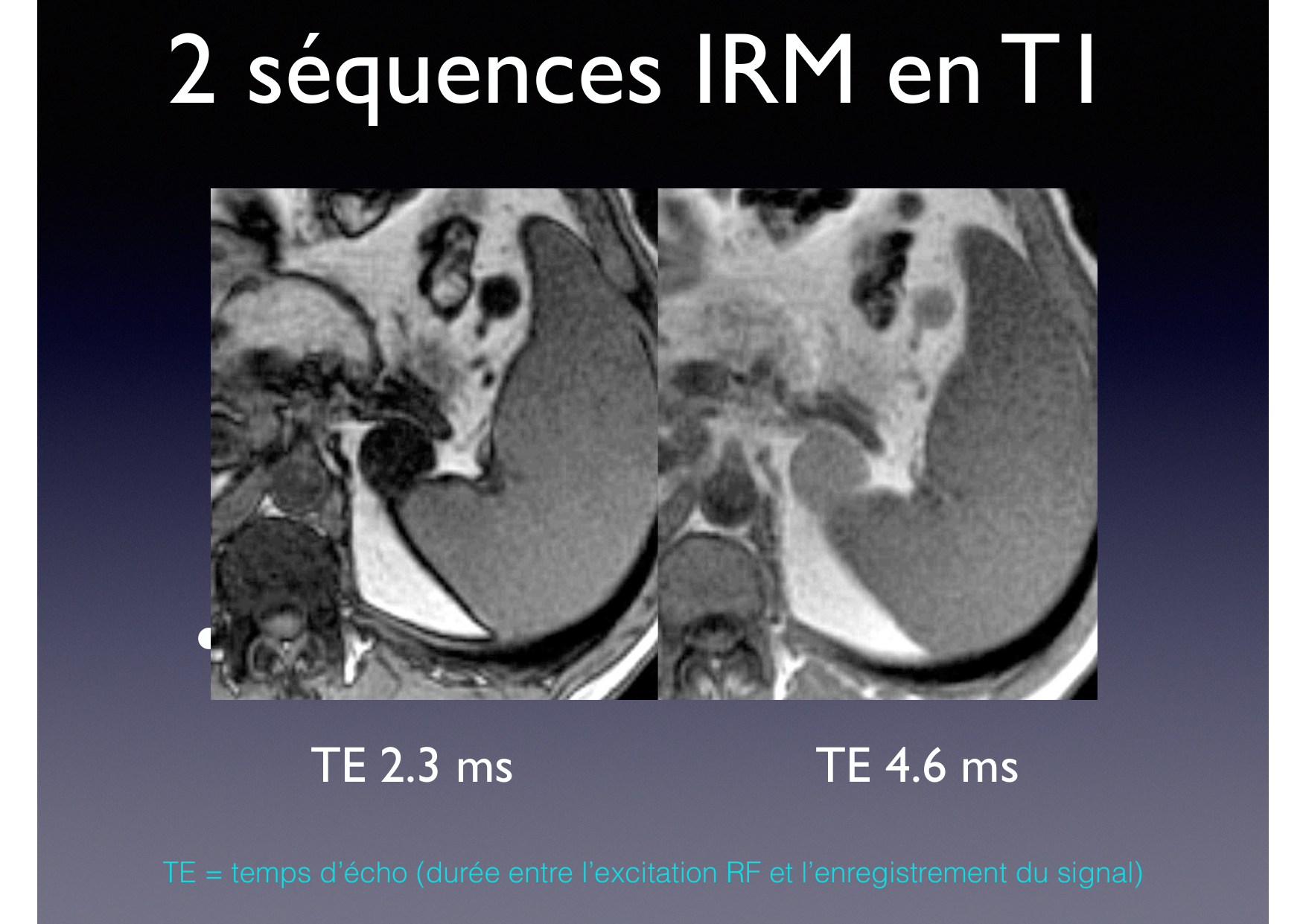 Intervention Prof JP Vallée - IRM - 17-02-2026 page 12