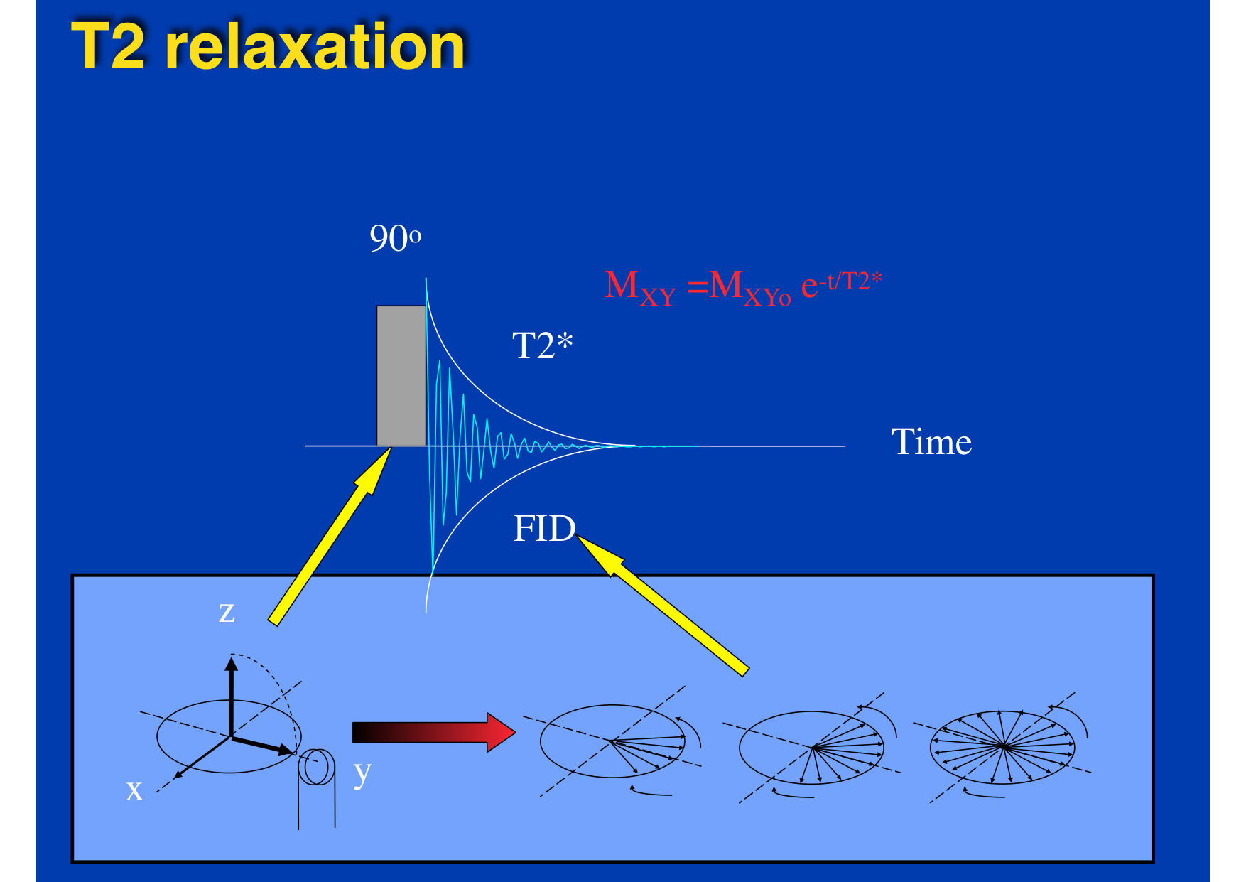 Intervention Prof JP Vallée - IRM - 17-02-2026 page 13