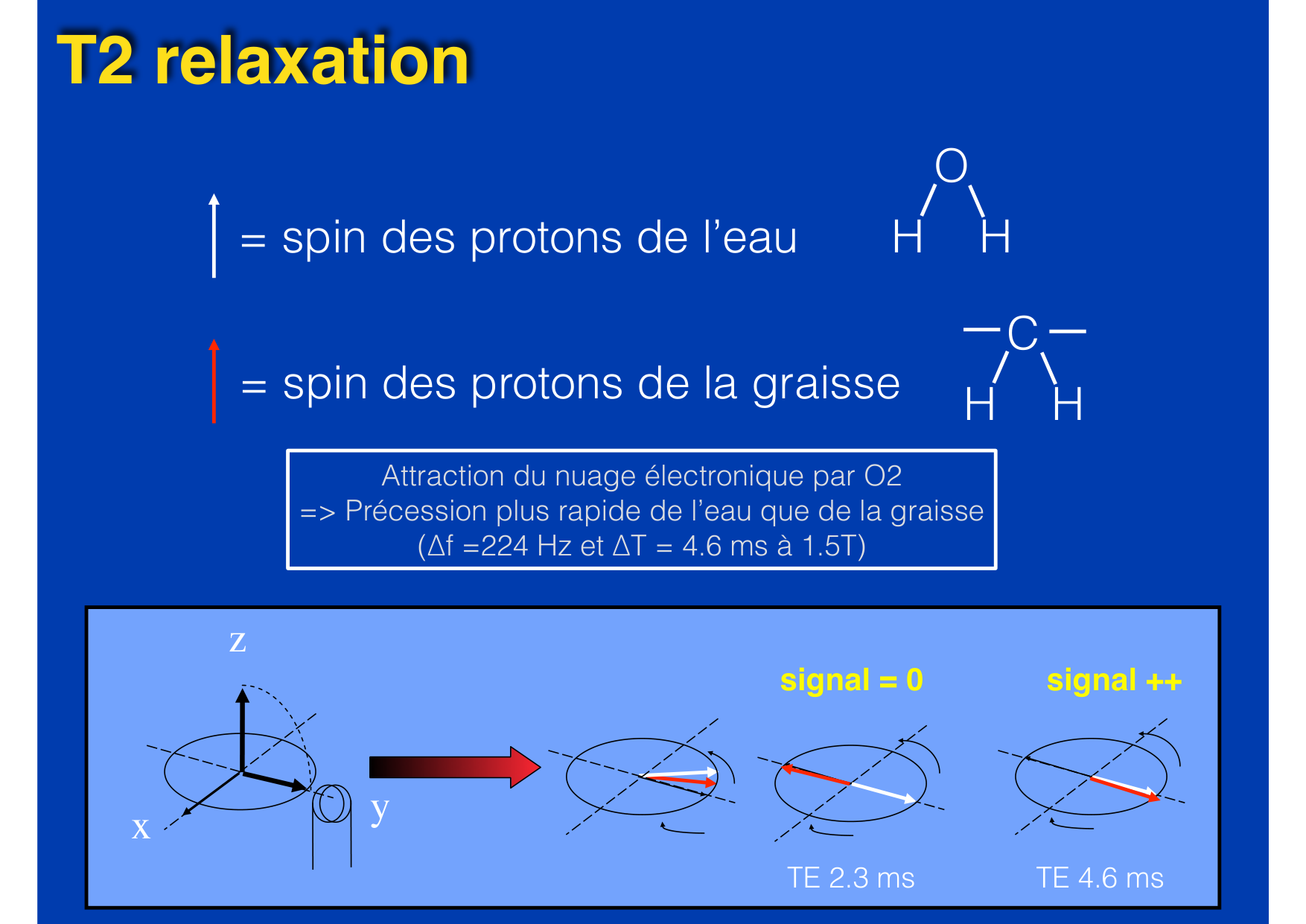 Intervention Prof JP Vallée - IRM - 17-02-2026 page 14