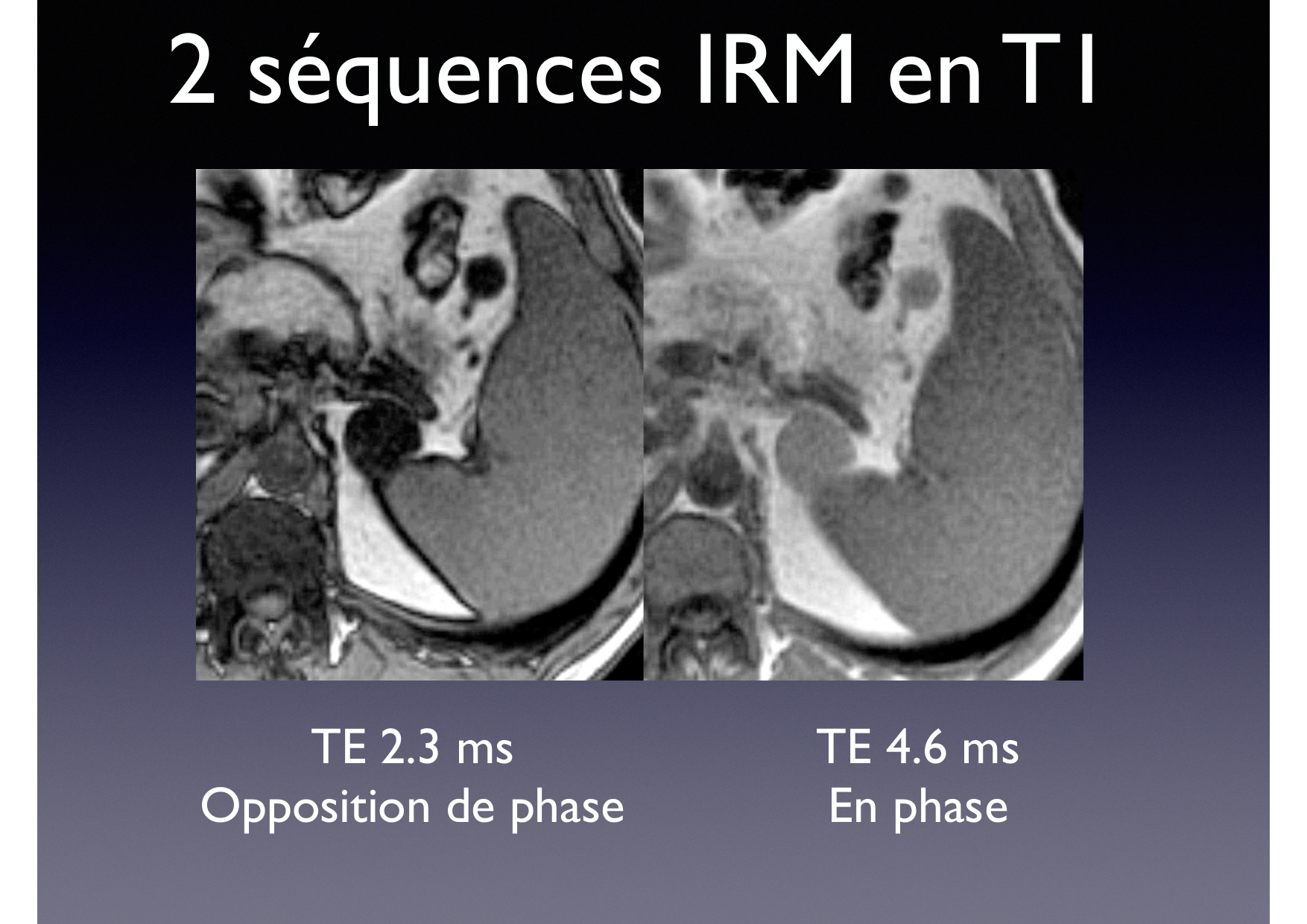 Intervention Prof JP Vallée - IRM - 17-02-2026 page 15