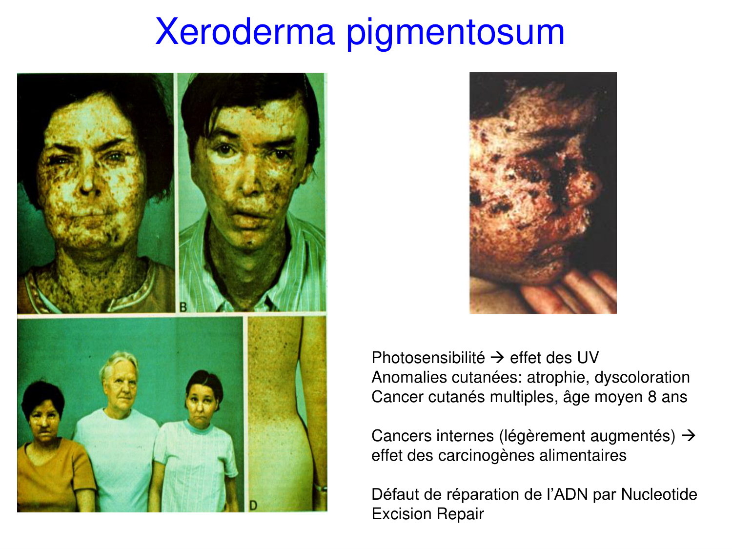 Oncogénétique page 38