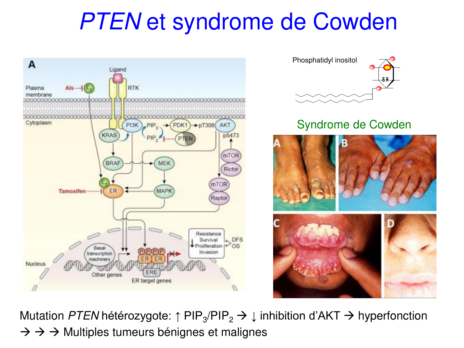 Oncogénétique page 45