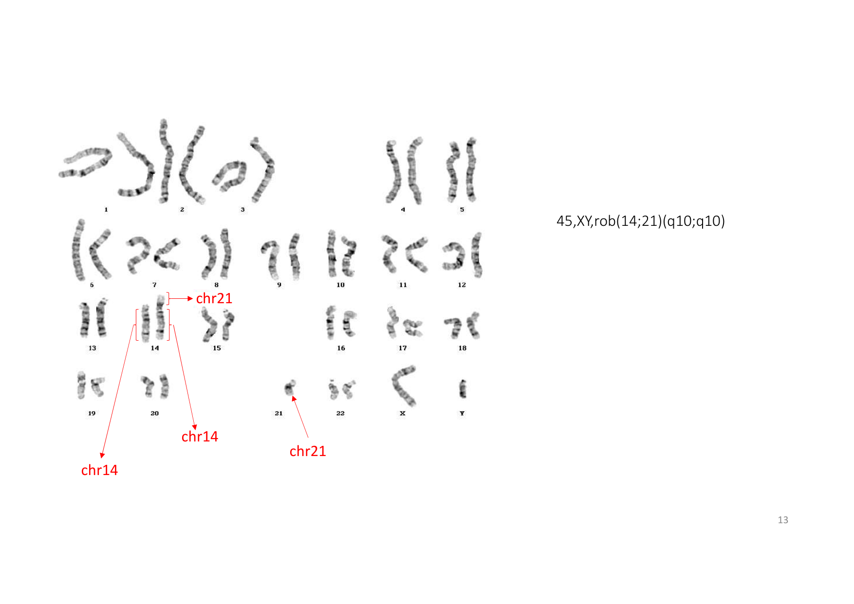 TD de génétique humaine · corrections page 13