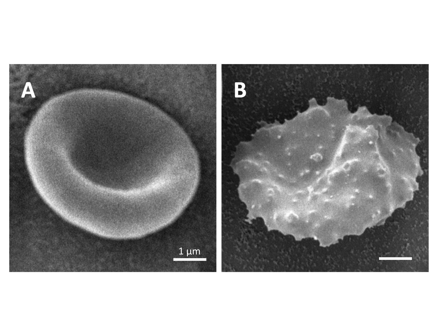 Les parasites — diapositives page 27
