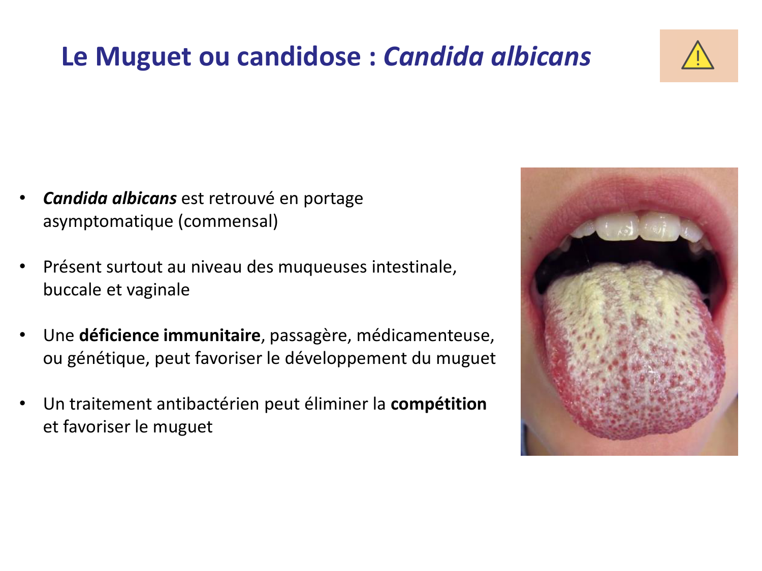 Les champignons — diapositives page 27