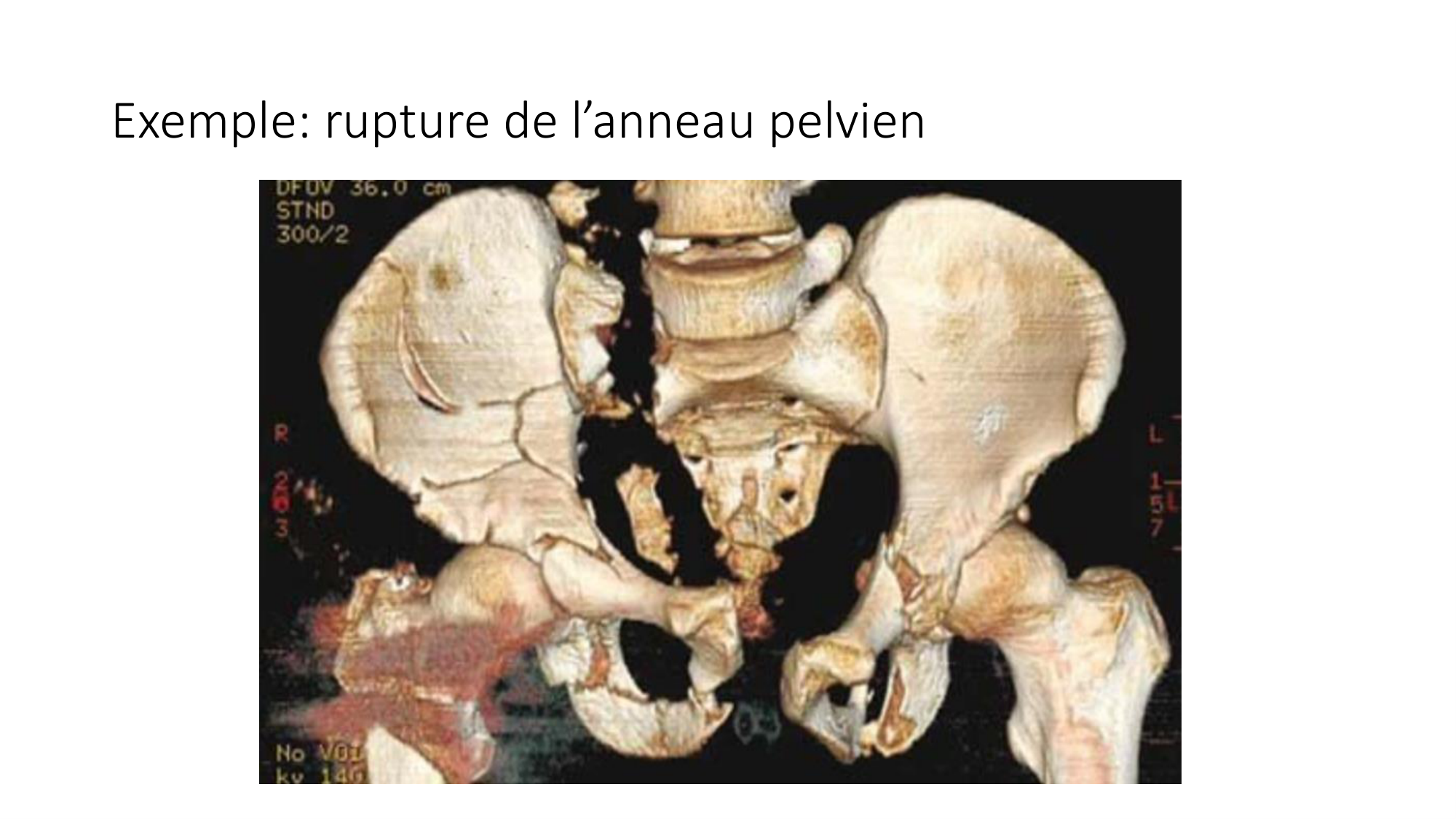 1 BA MI hanche 2025-26 page 13