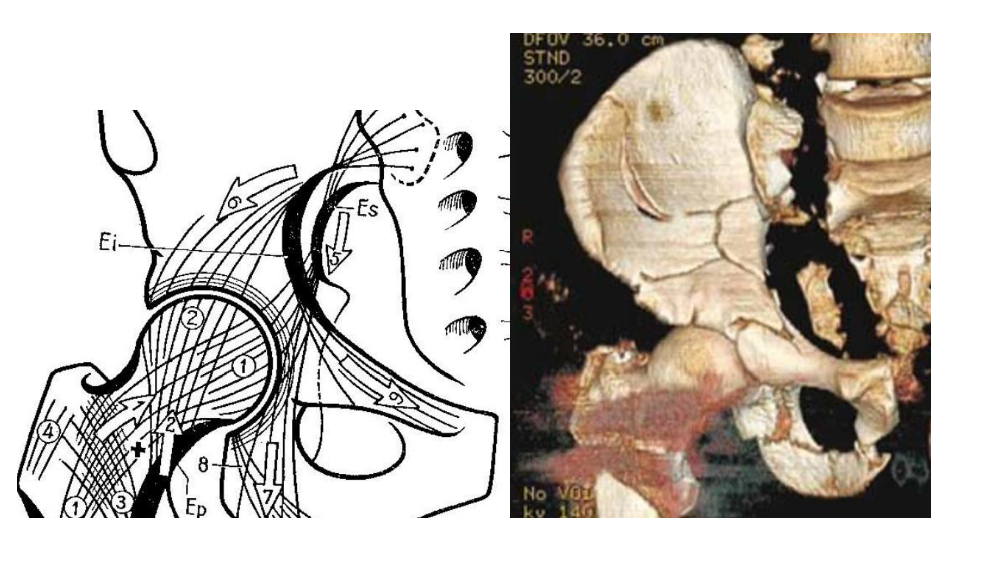 1 BA MI hanche 2025-26 page 14