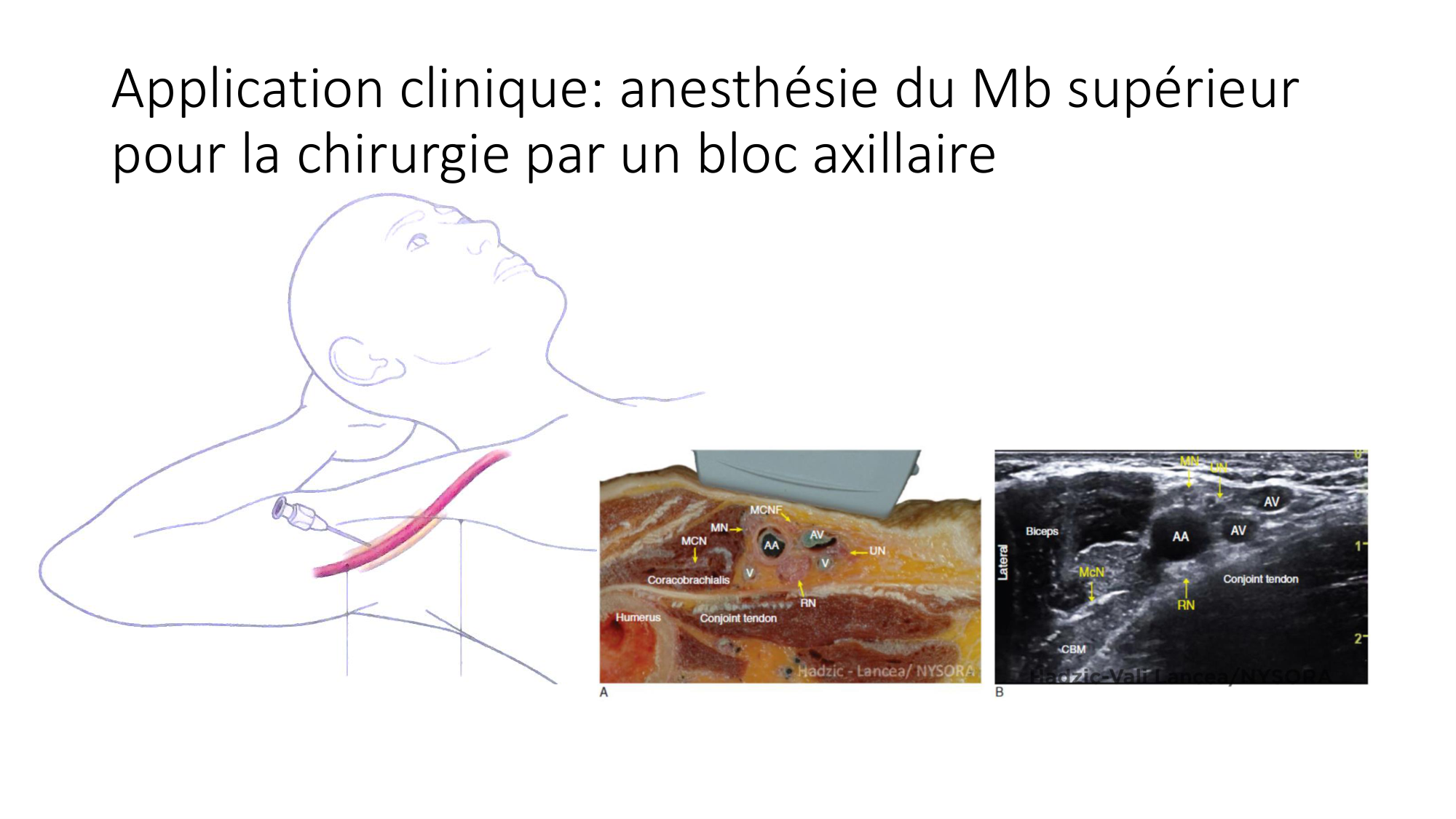 1 BA MS épaule 2025-26 page 49