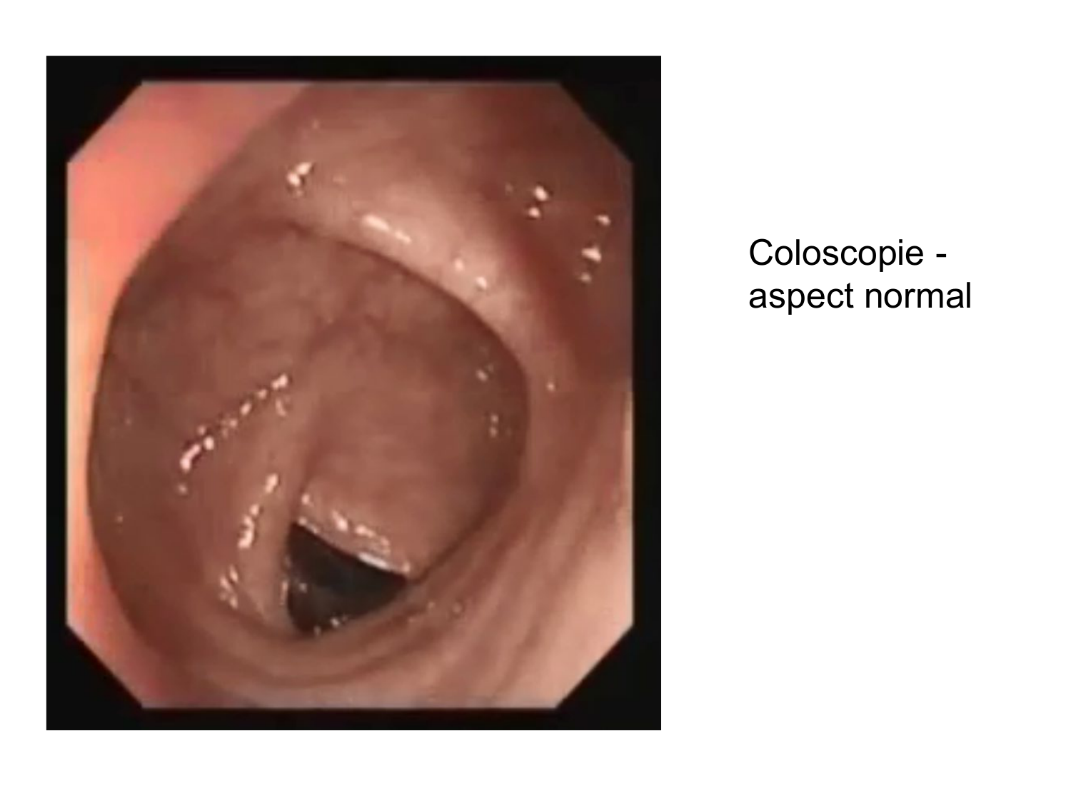 Abdomen gros intestin foie rate pancreas vascularisation page 20