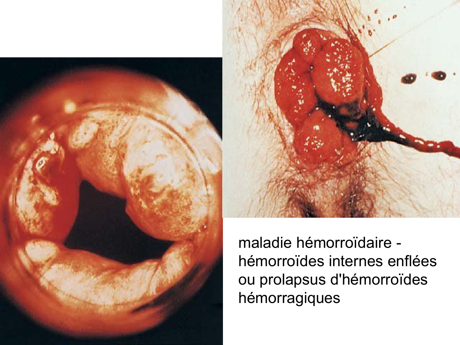 Abdomen gros intestin foie rate pancreas vascularisation page 31