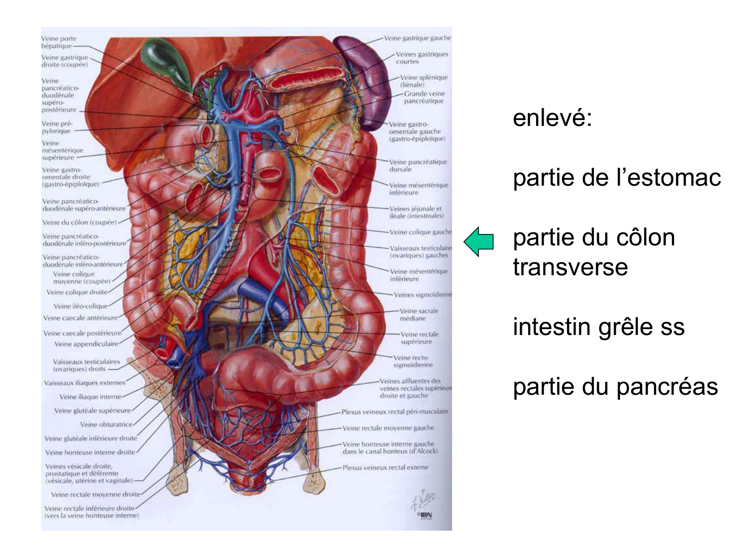 Abdomen gros intestin foie rate pancreas vascularisation page 42