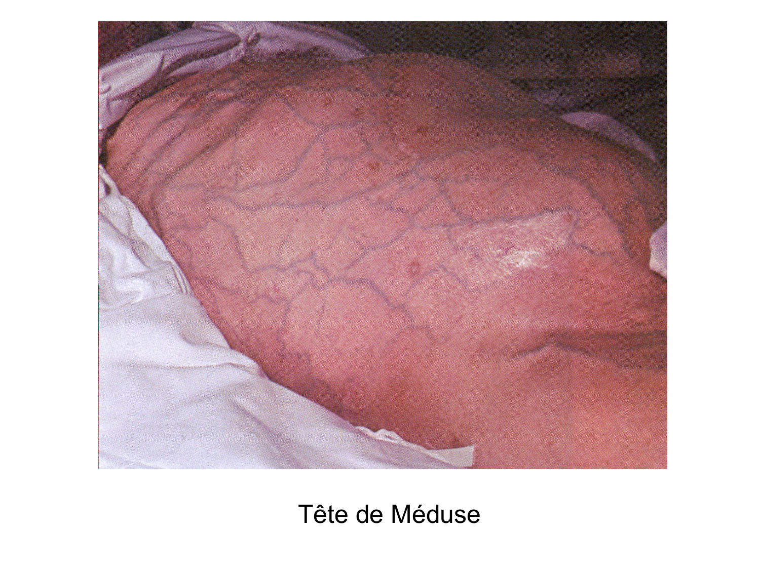 Abdomen gros intestin foie rate pancreas vascularisation page 46